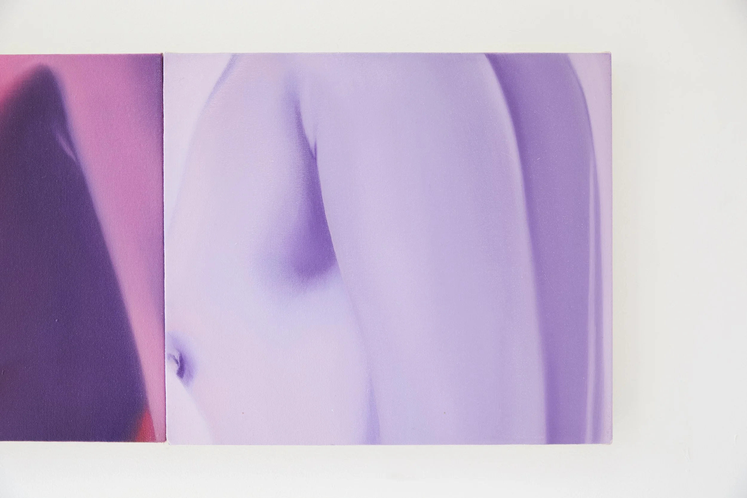  Installation view. 