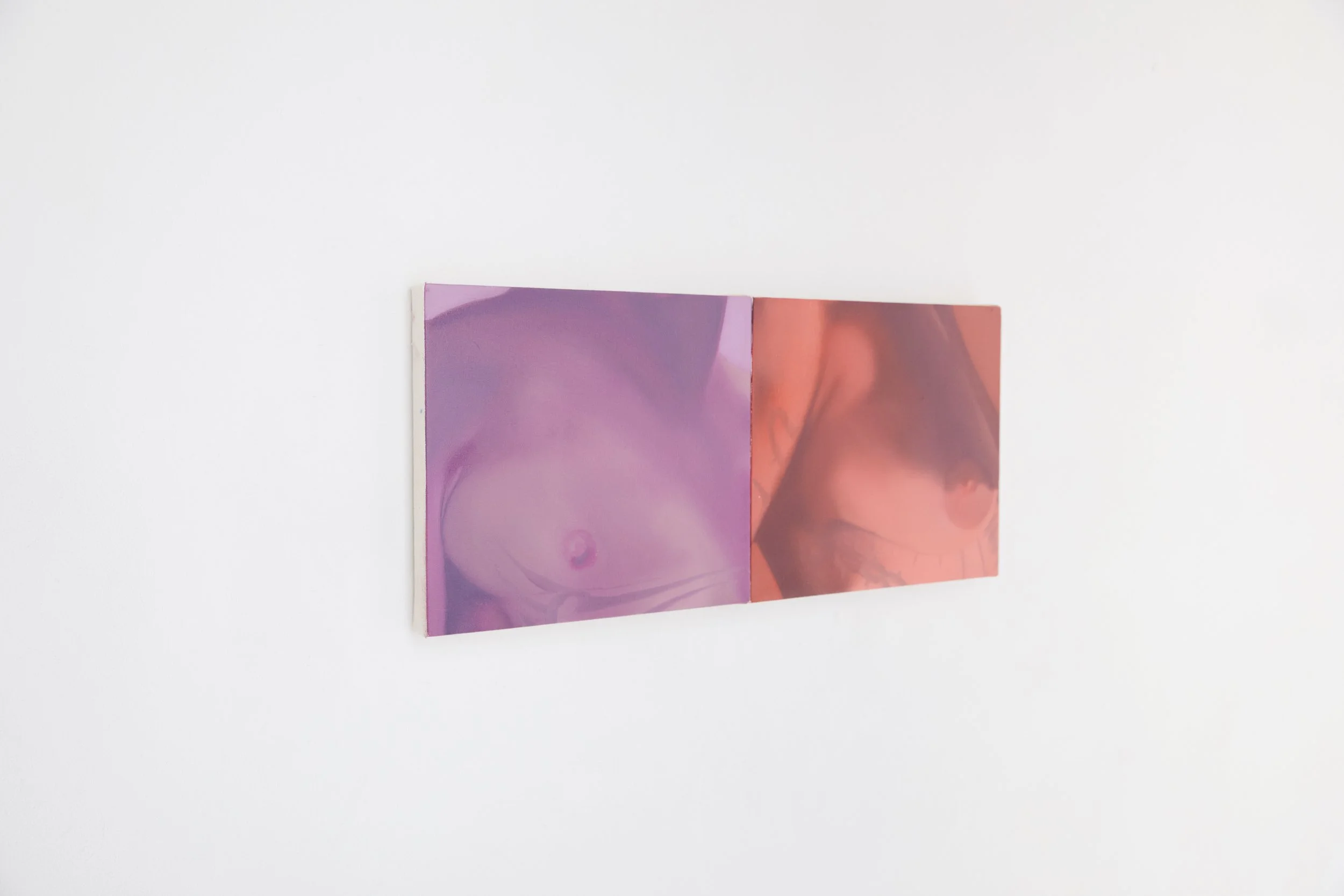  Installation view. 