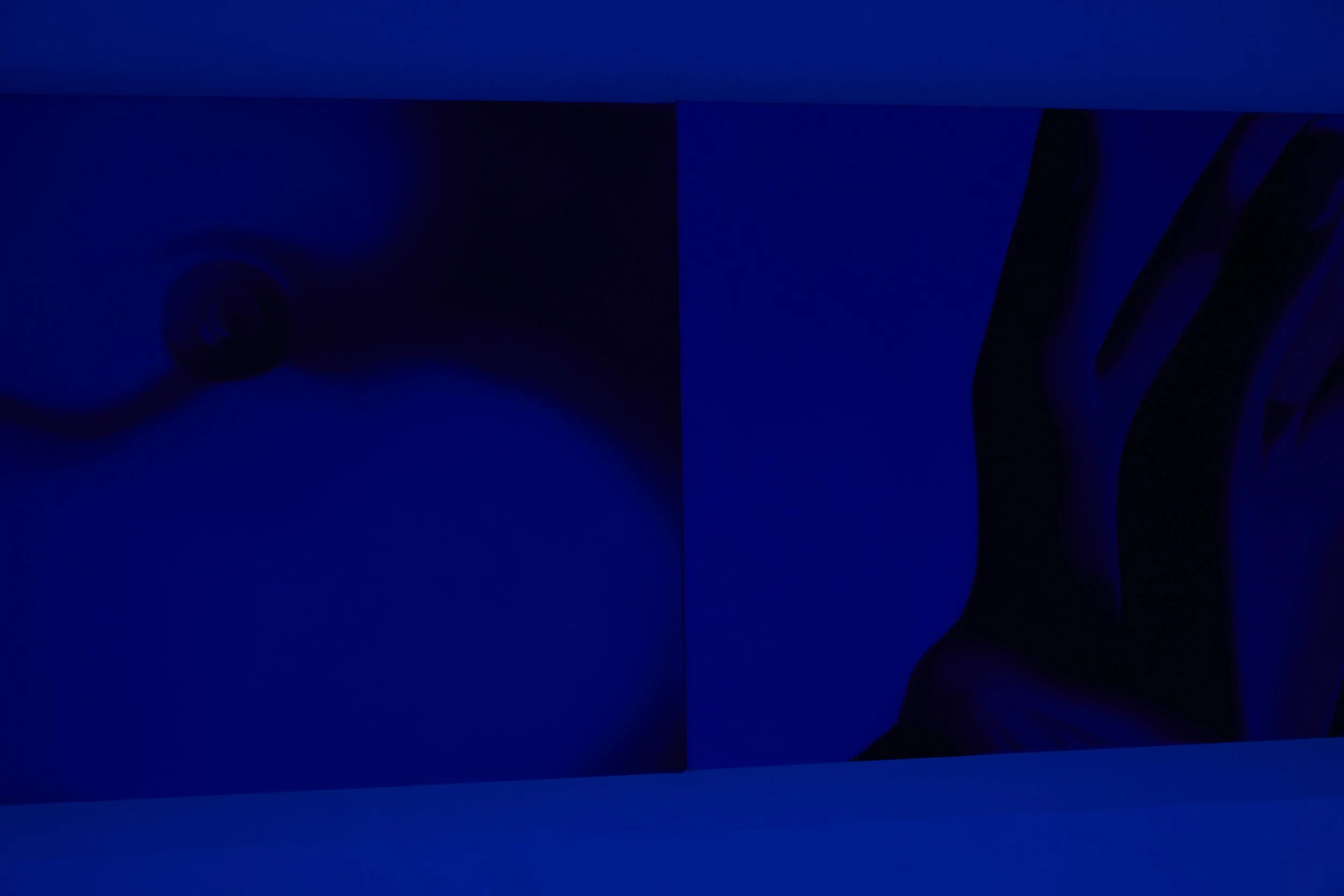  Installation view. 