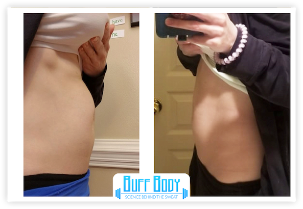 Diastasis Recti or Hernia: is it the same? — Buff Body Fitness