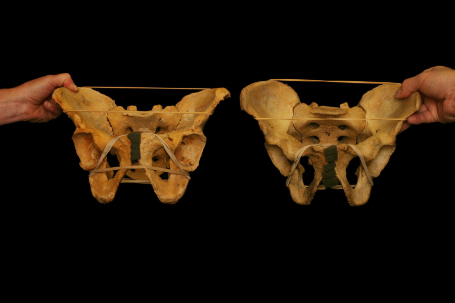 Anterior Pelvic Tilt