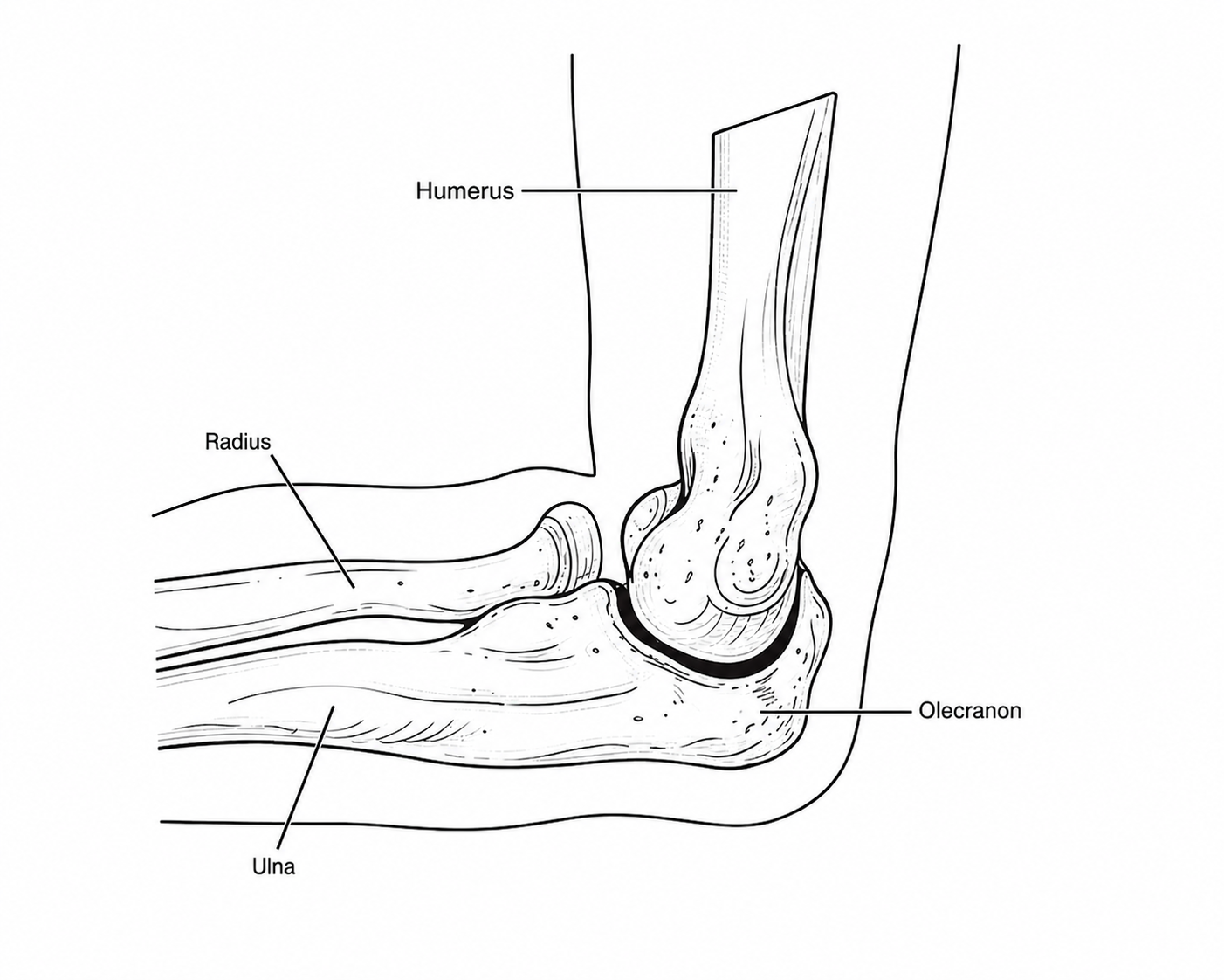 Should Hypermobile Students Avoid Locking Their Elbows?