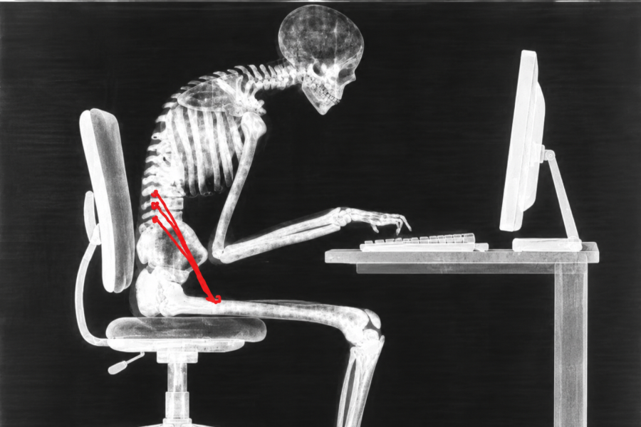 Does sitting all day really shorten your psoas?