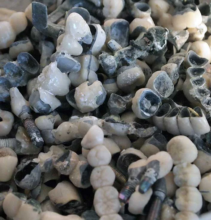palladium-dental-lab-scrap-buyers.jpg