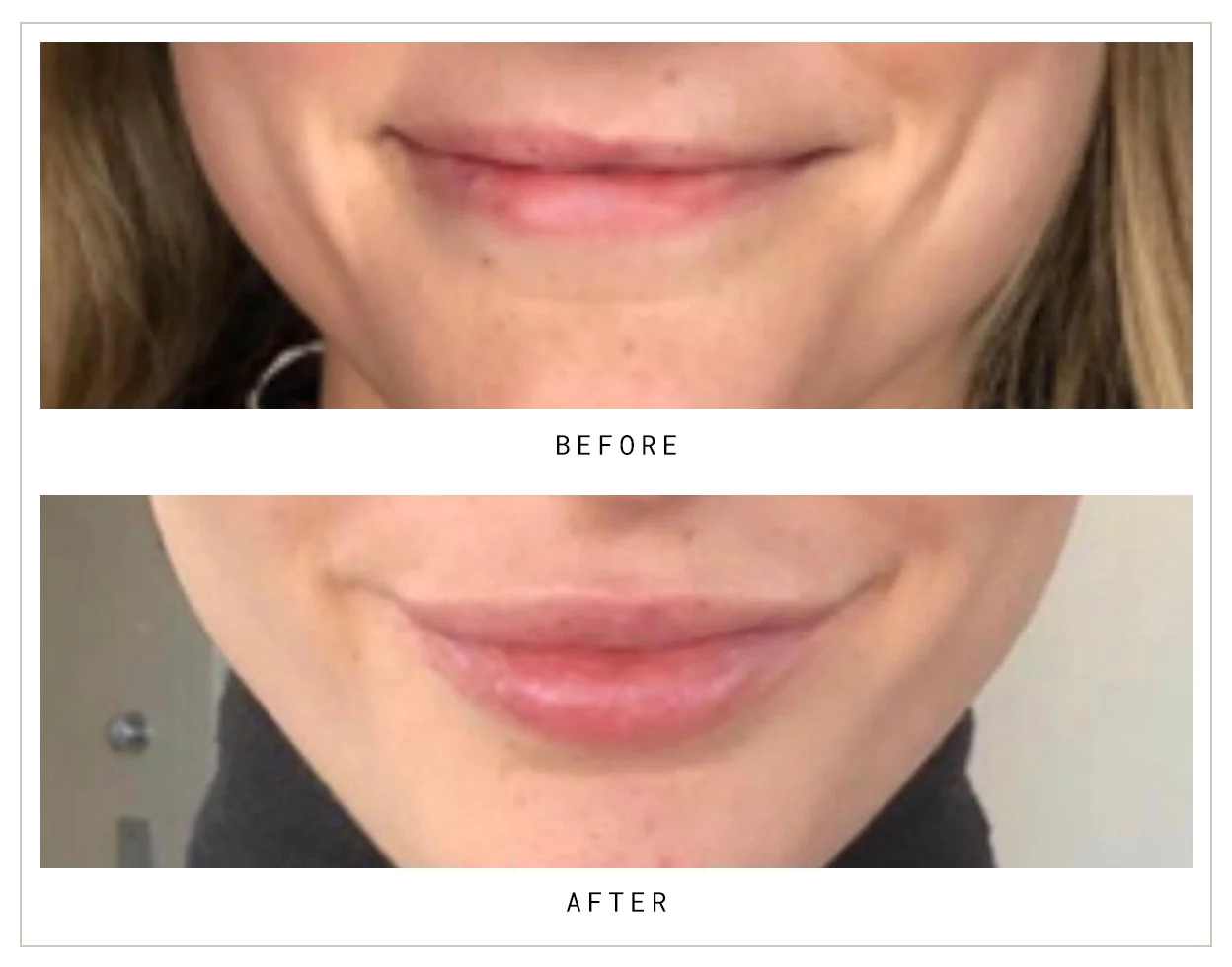 Mocks_Dermal1.jpg
