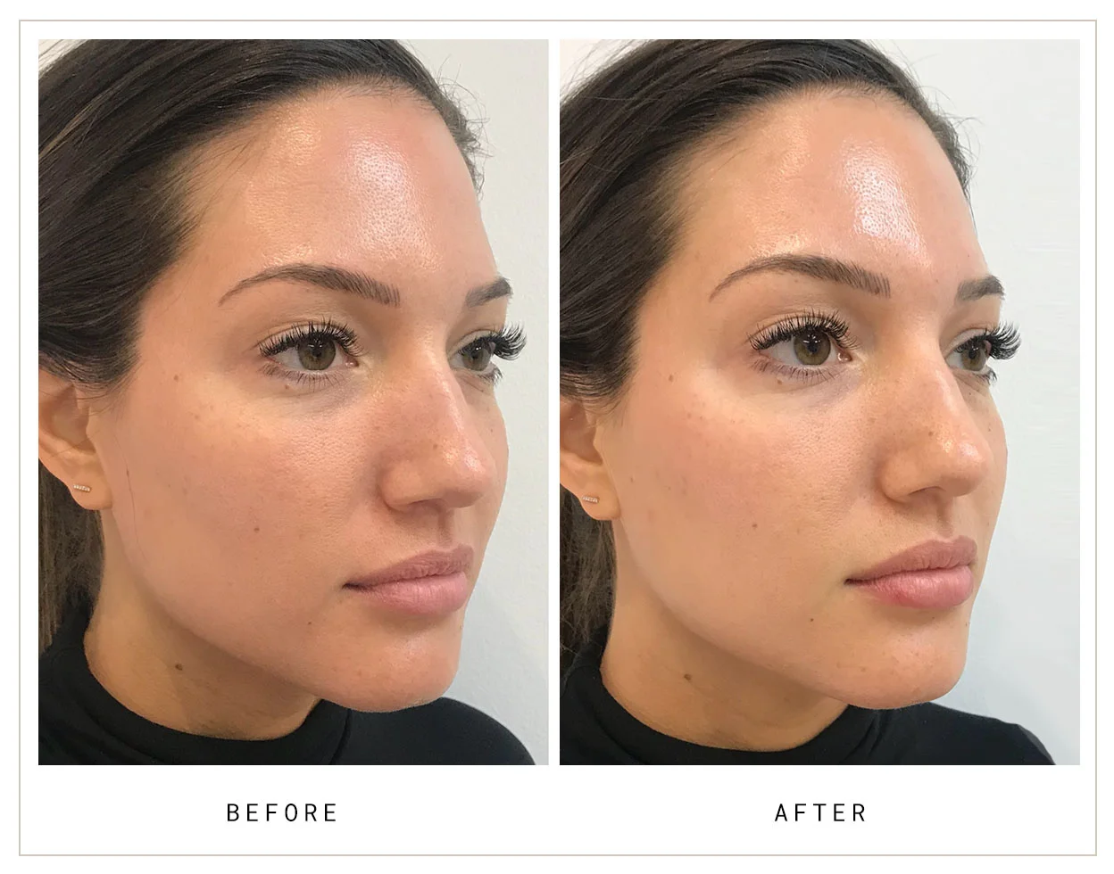Mocks_Dermal4.jpg