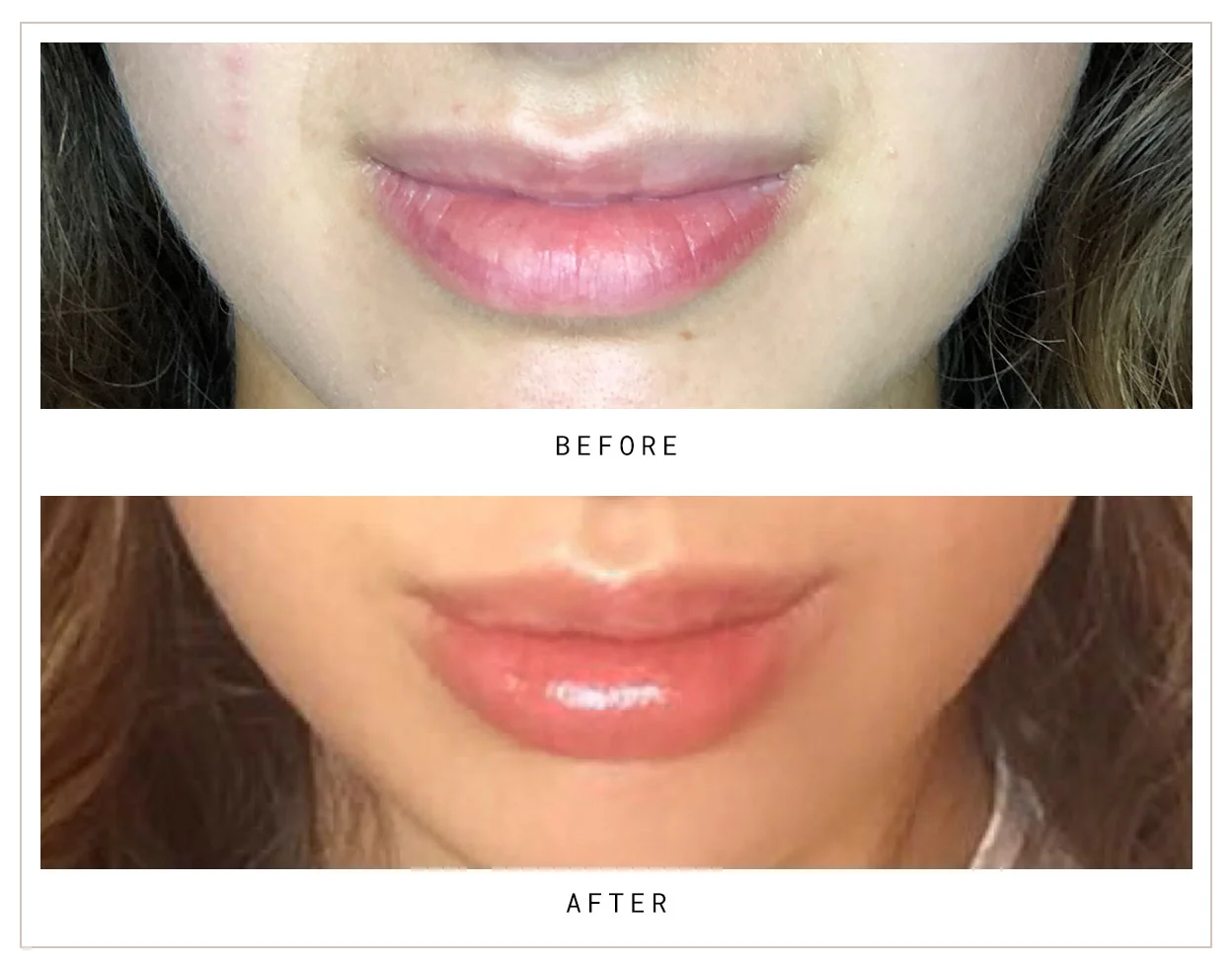 Mocks_Dermal10.jpg