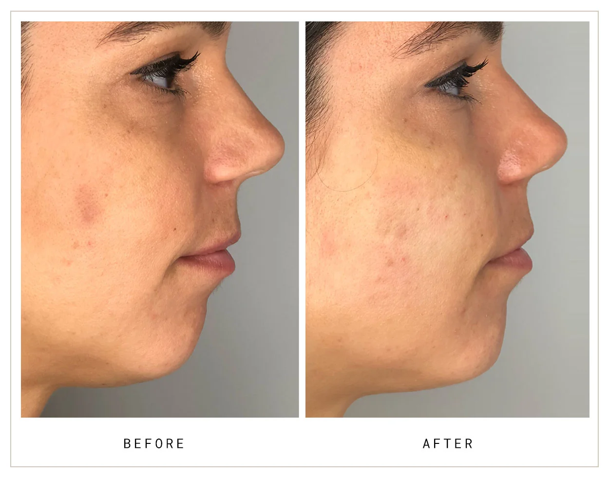 Mocks_Dermal6.jpg