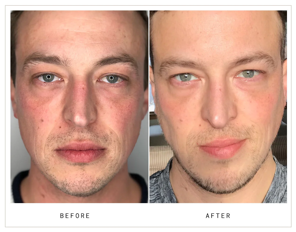 Mocks_Dermal12.jpg