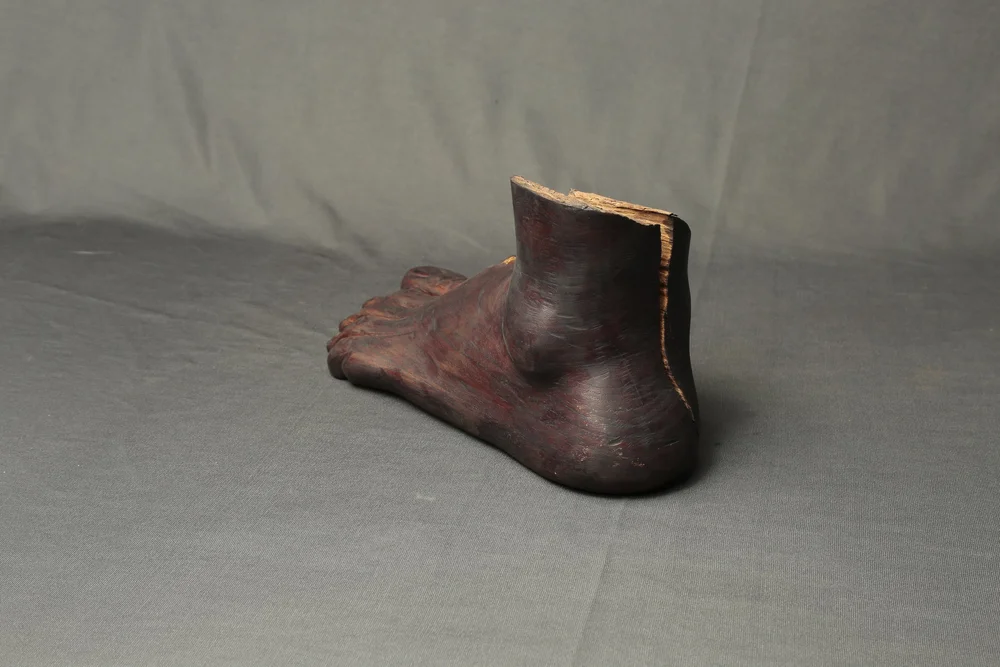 Broken Foot
