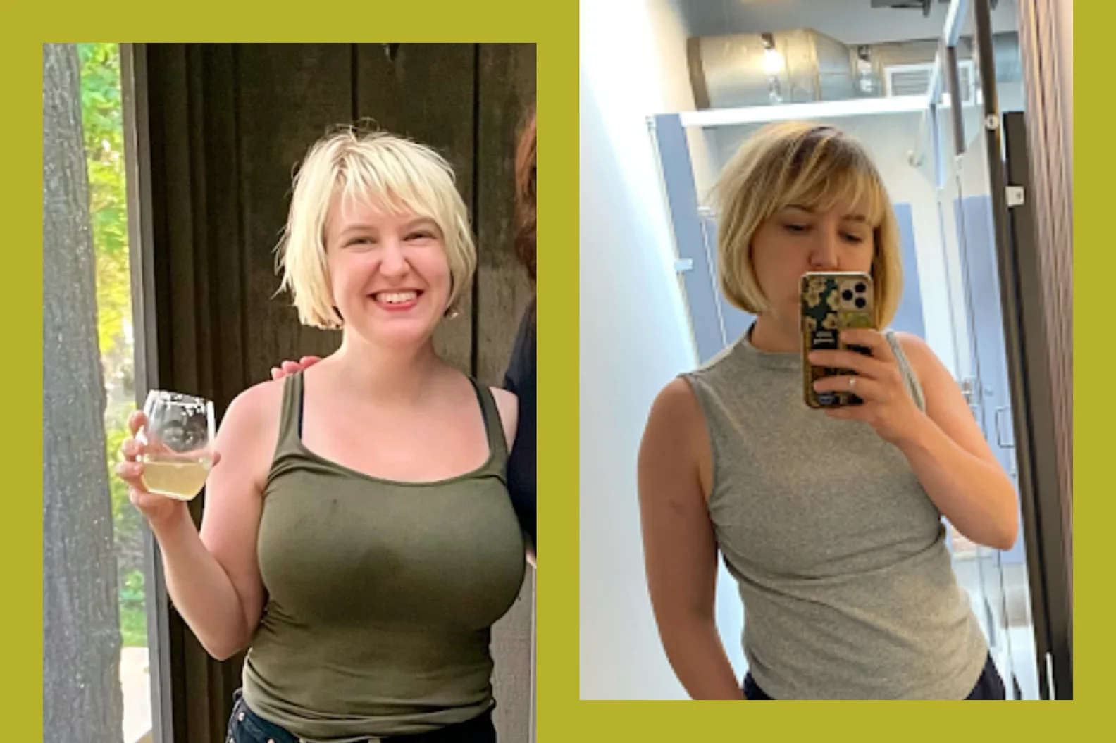 How a Breast Reduction Improved My Life