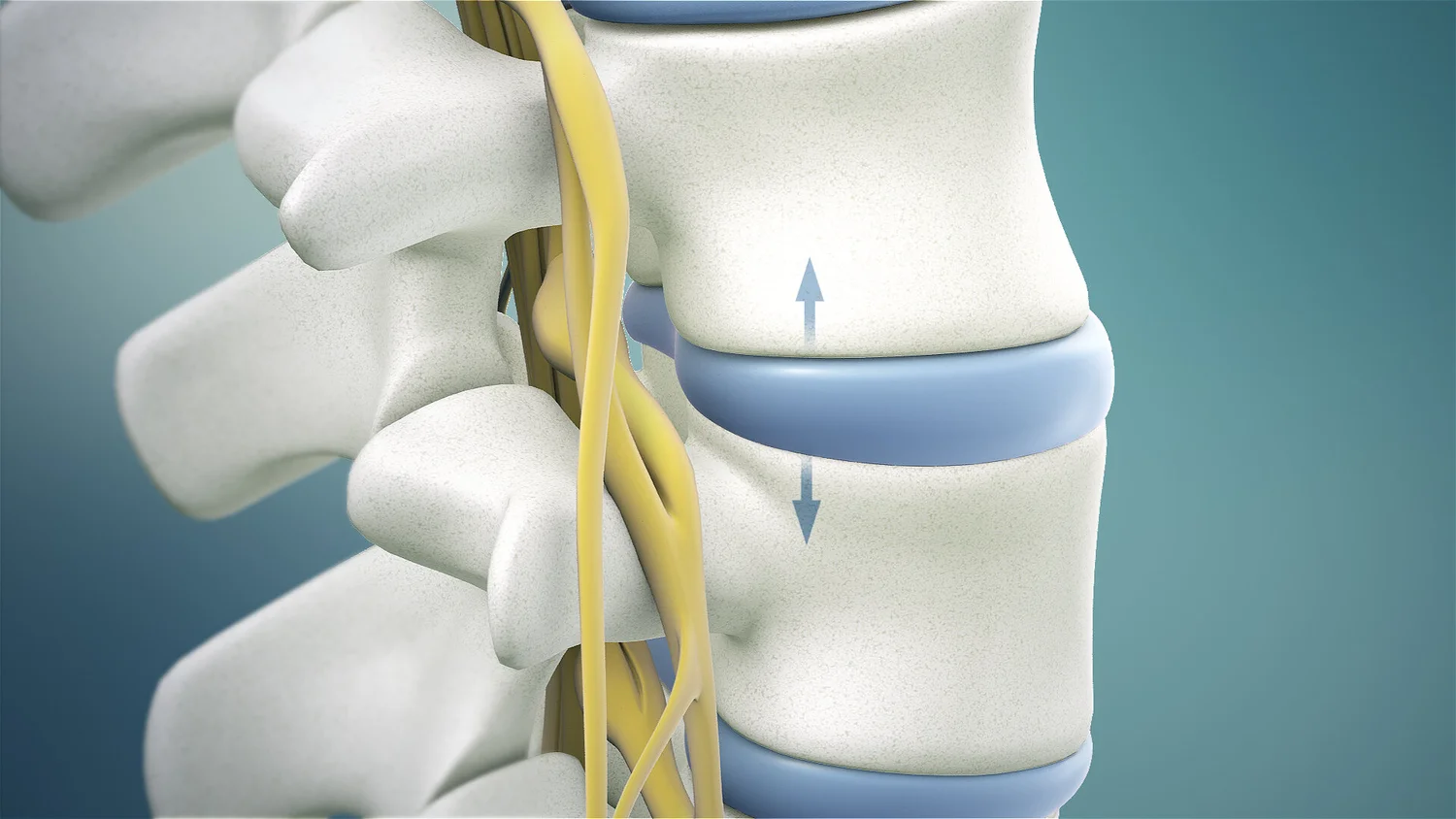 The Stages of Degenerative Disc Disease | Physiotherapists in Toronto ...