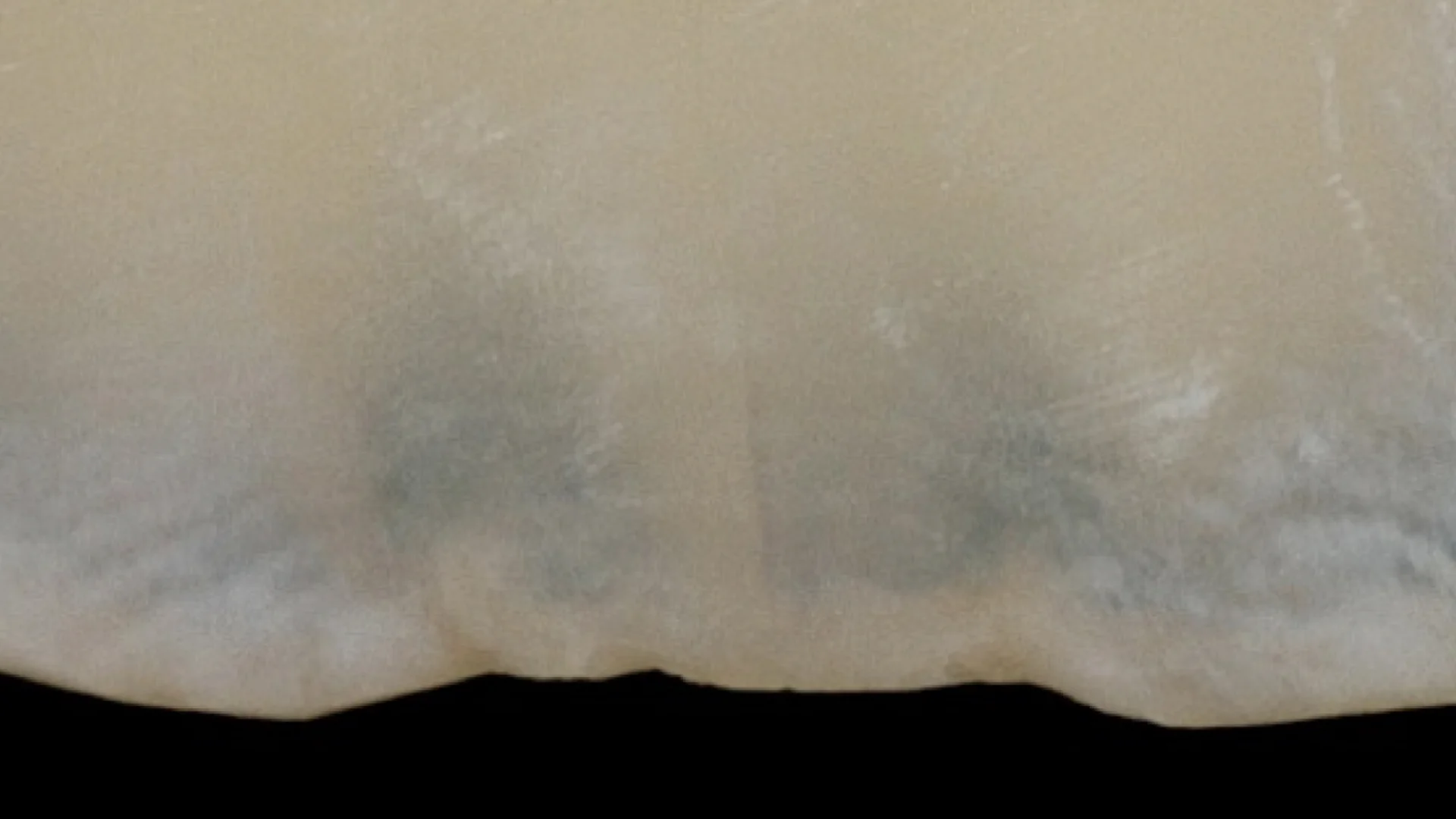 DENTER IMAGES.008.jpeg