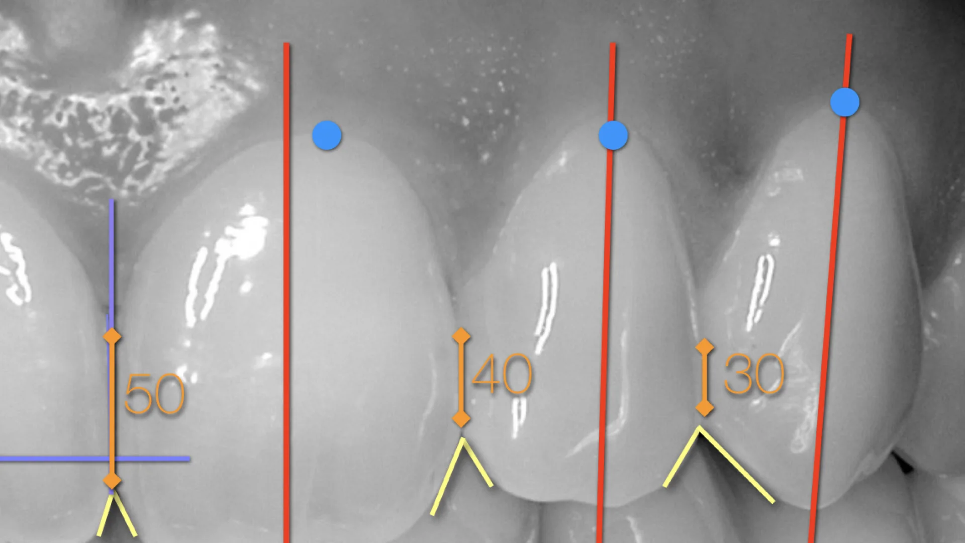 DENTER IMAGES.011.jpeg