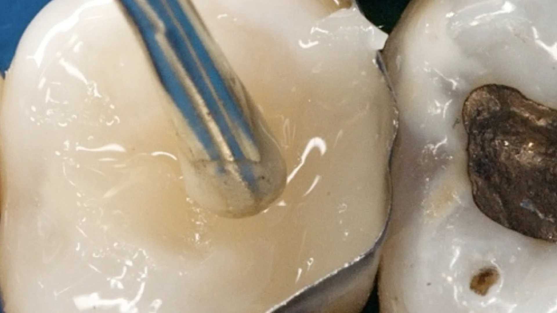 DENTER IMAGES.006.jpeg