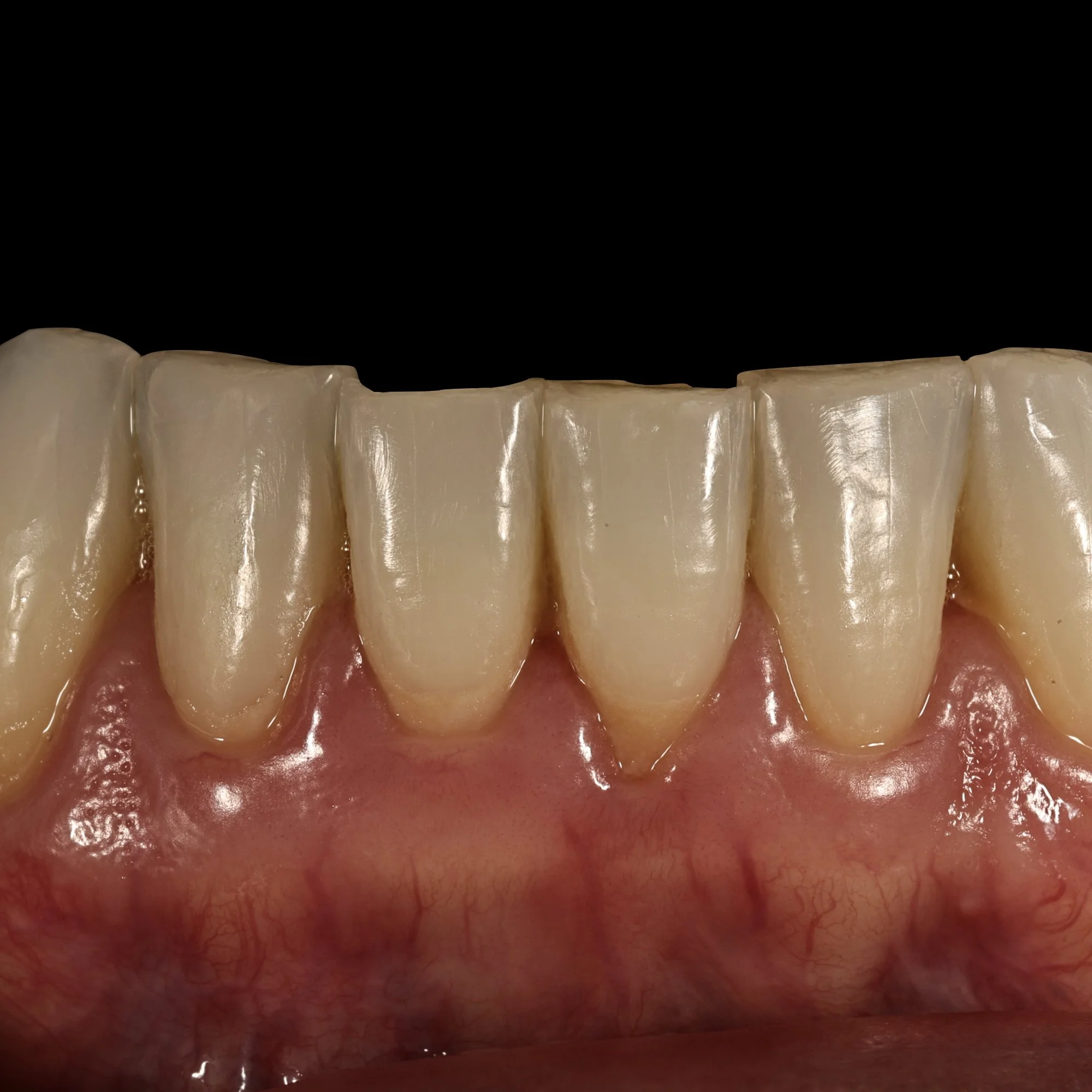 dentalphotoimages.003.jpeg