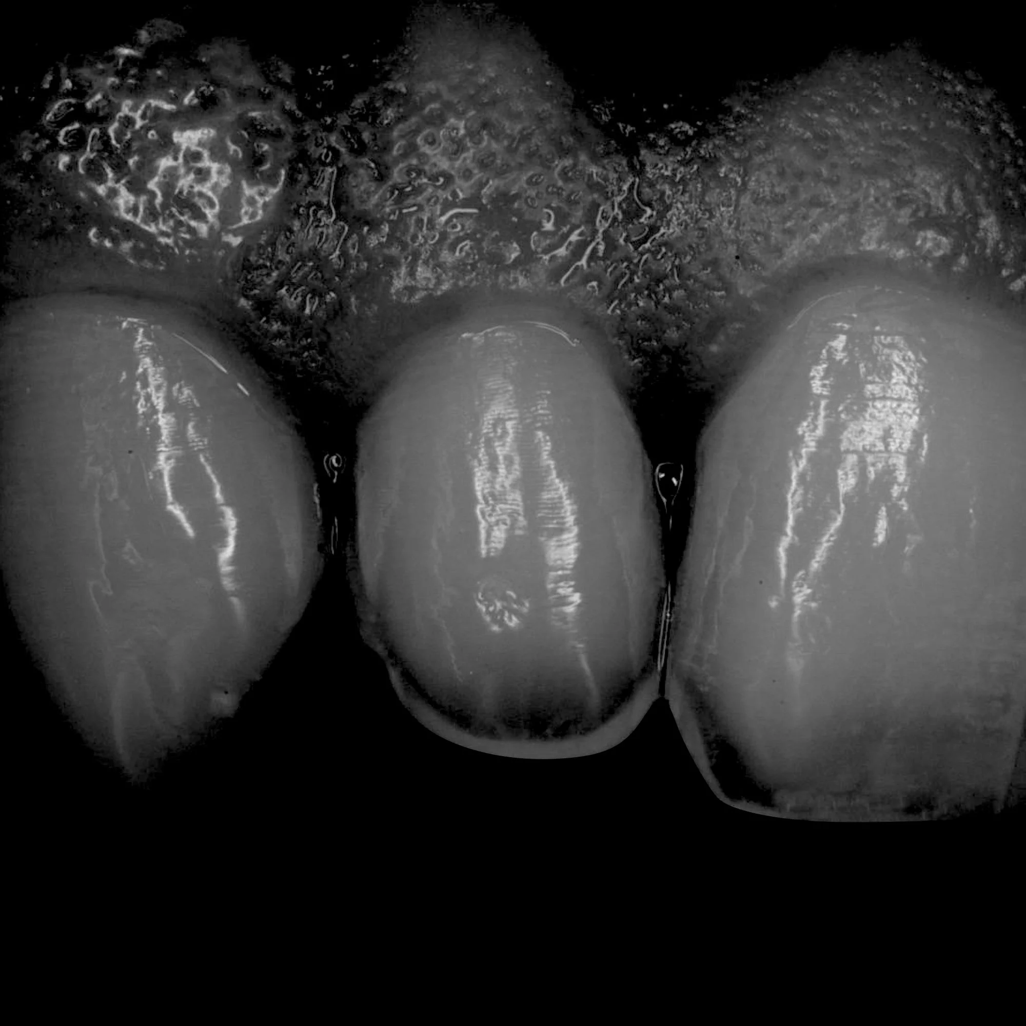 dentalphotoimages.014.jpeg