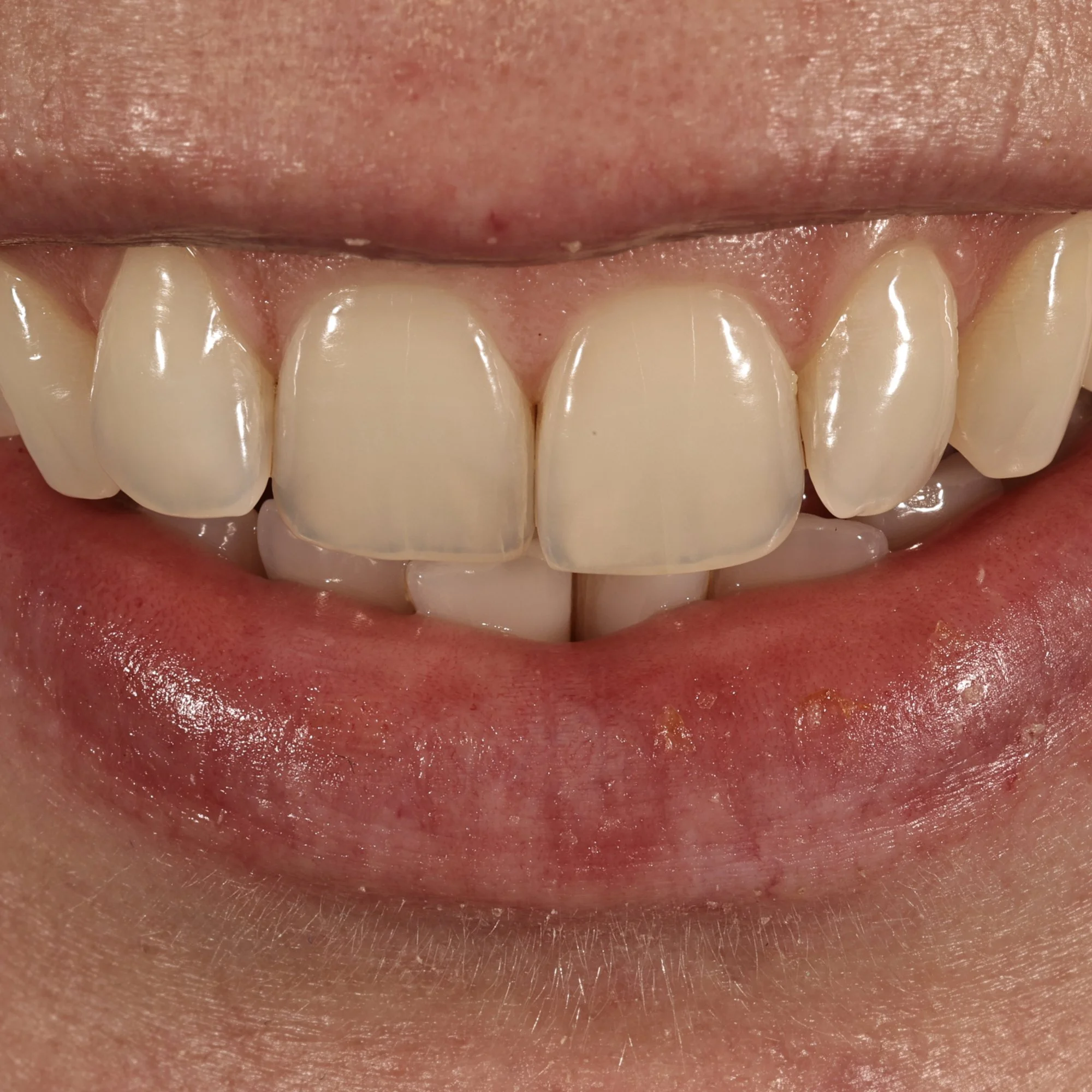 dentalphotoimages.015.jpeg