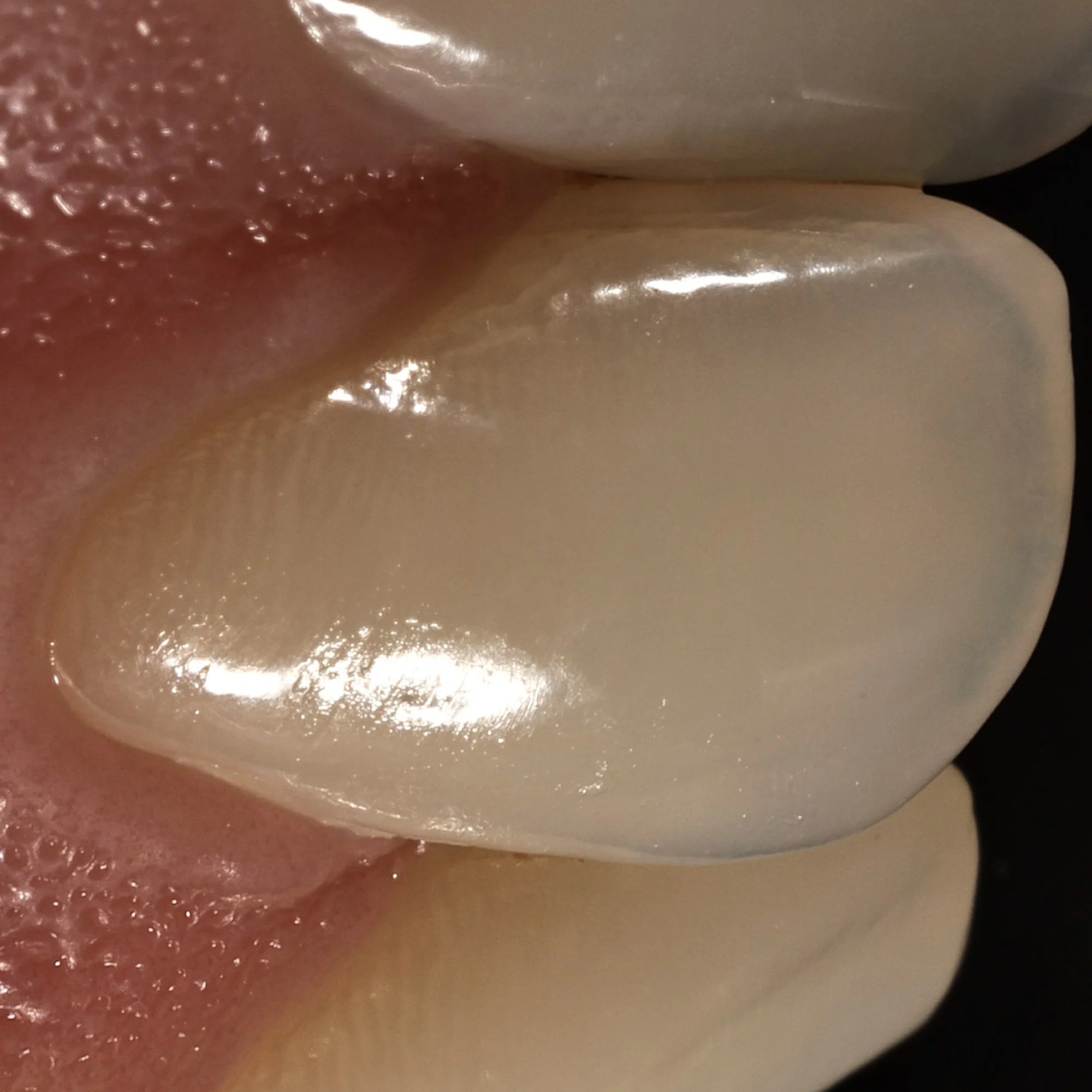 dentalphotoimages.007.jpeg