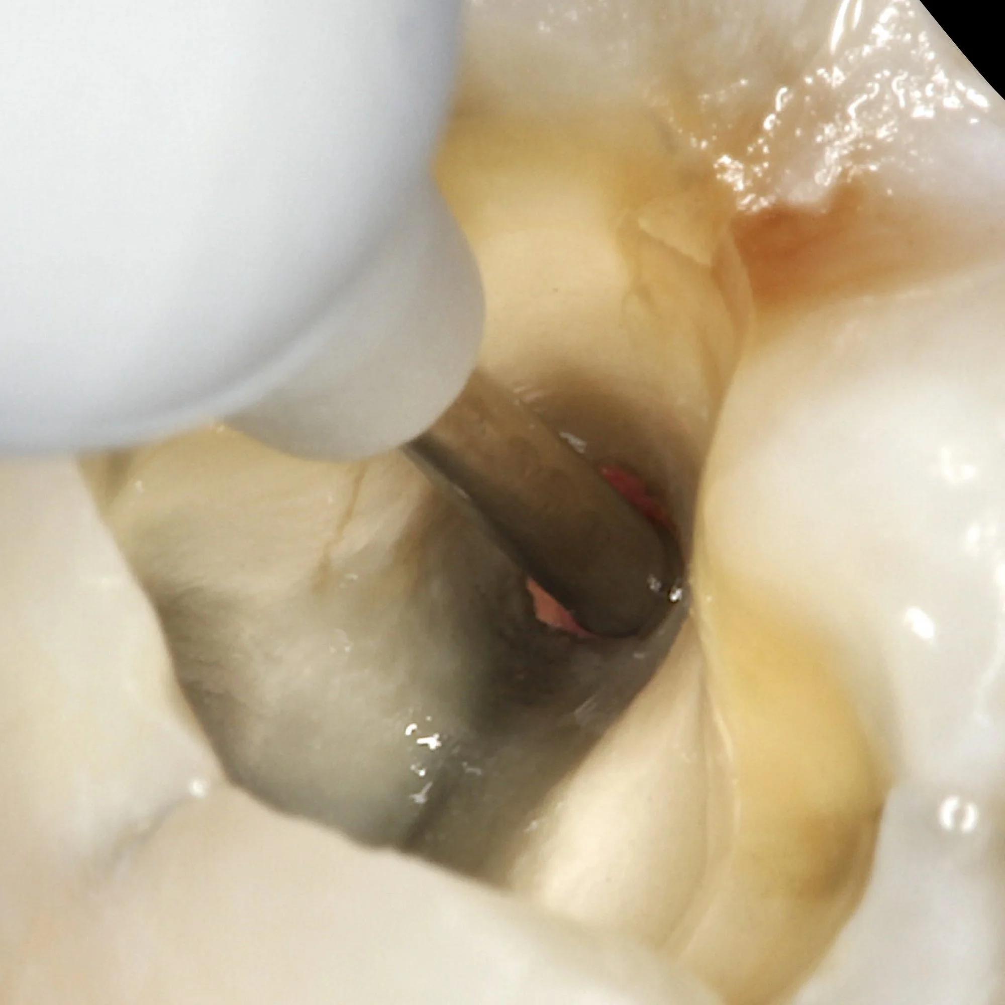 dentalphotoimages.004.jpeg