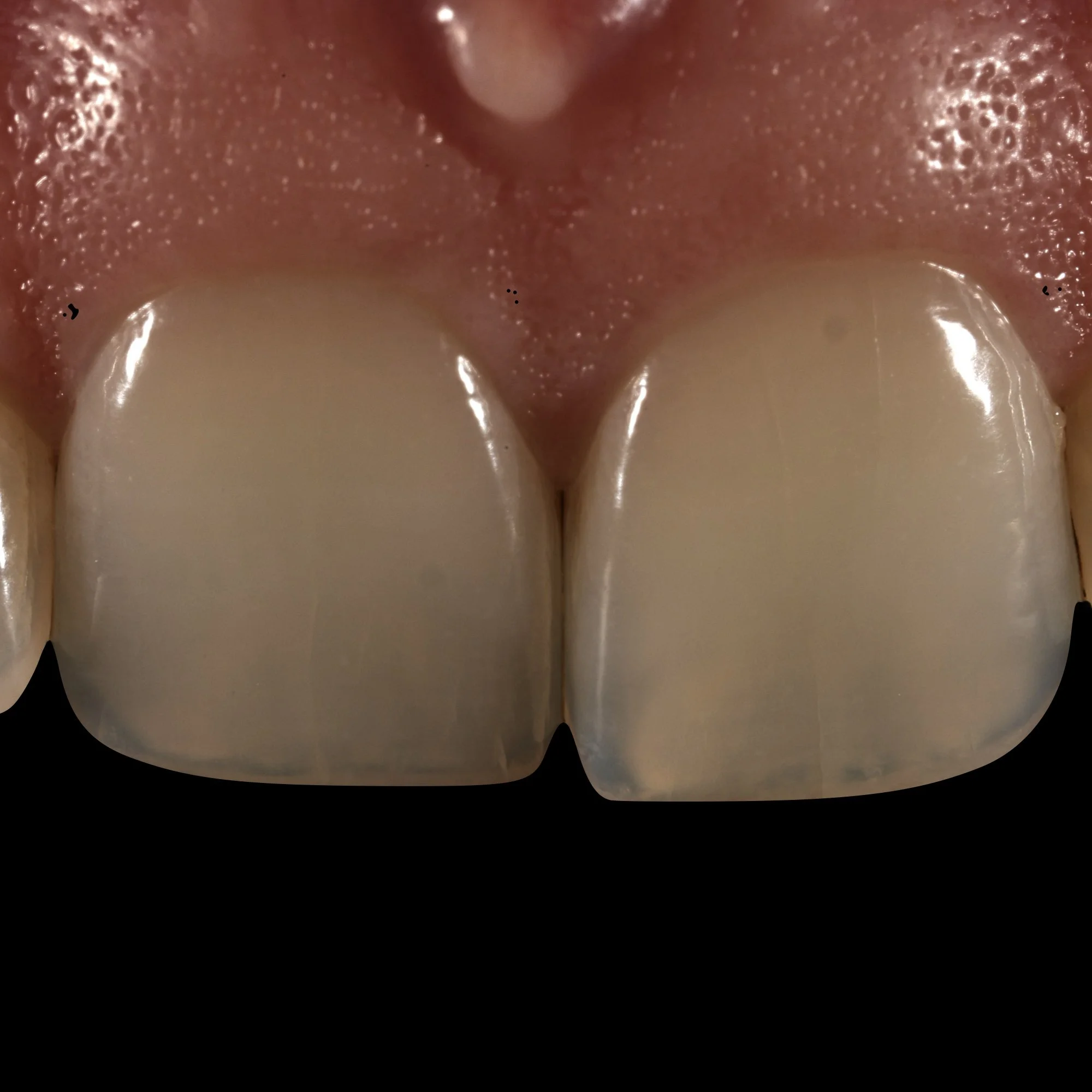 dentalphotoimages.012.jpeg