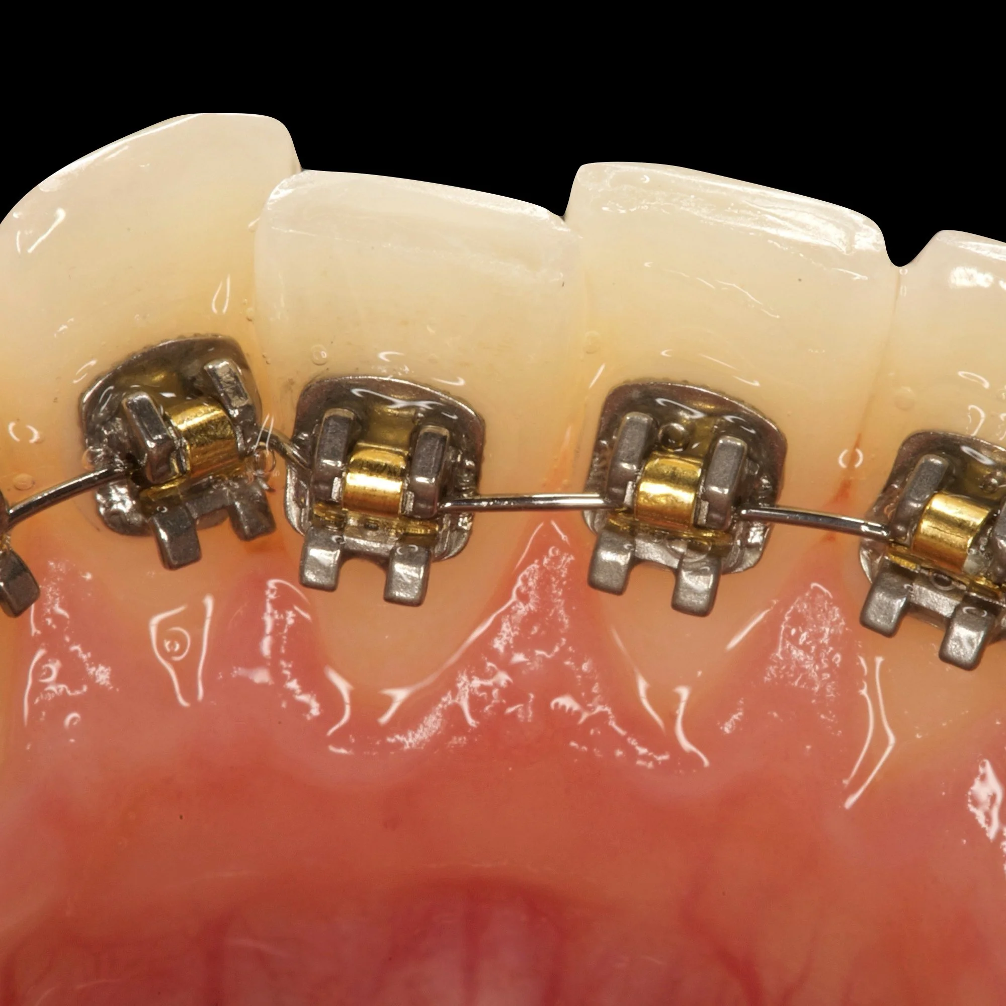 dentalphotoimages.010.jpeg