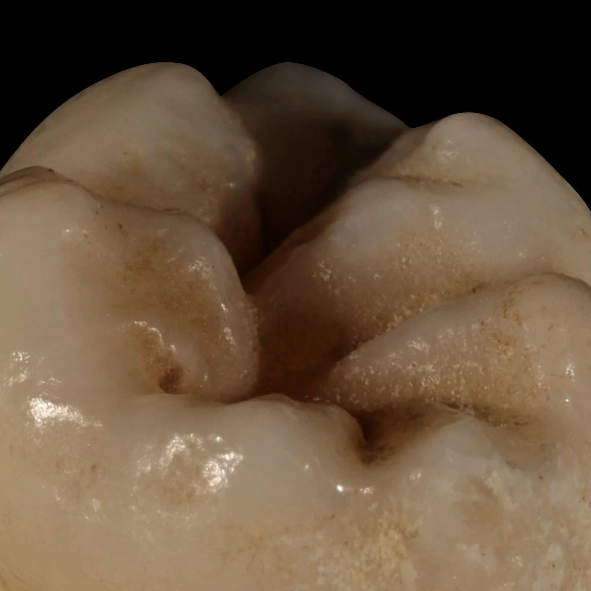 dentalphotoimages.013.jpeg