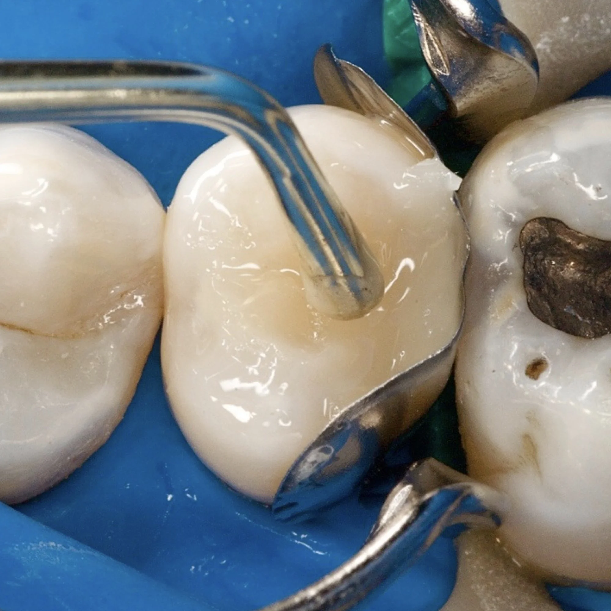 dentalphotoimages.011.jpeg