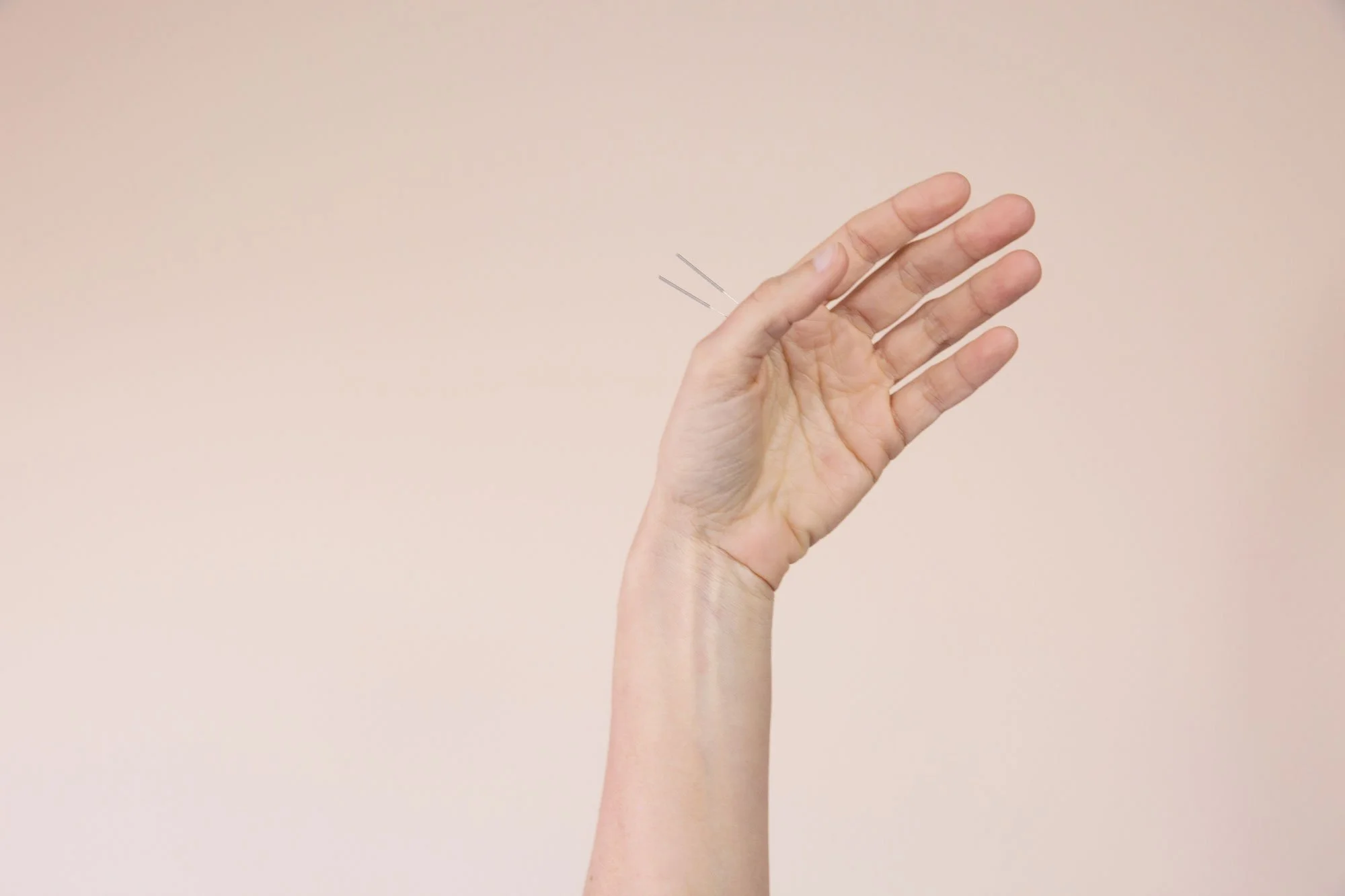 acupuncture point fu ke on hand Master Tung points