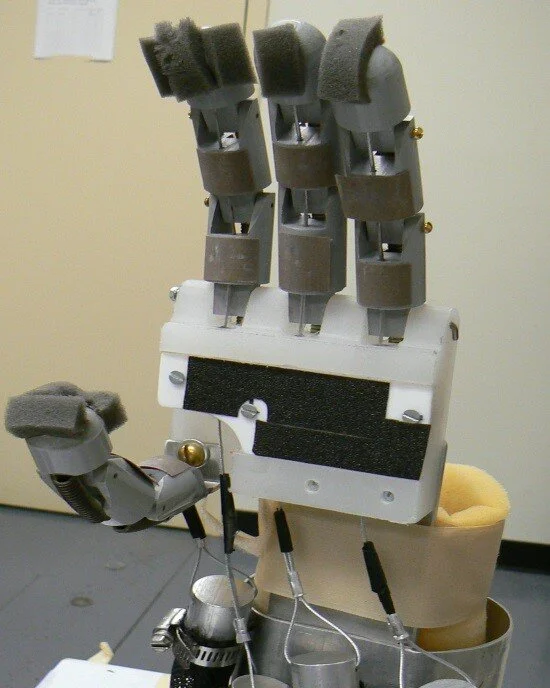 Prosthetic Hand