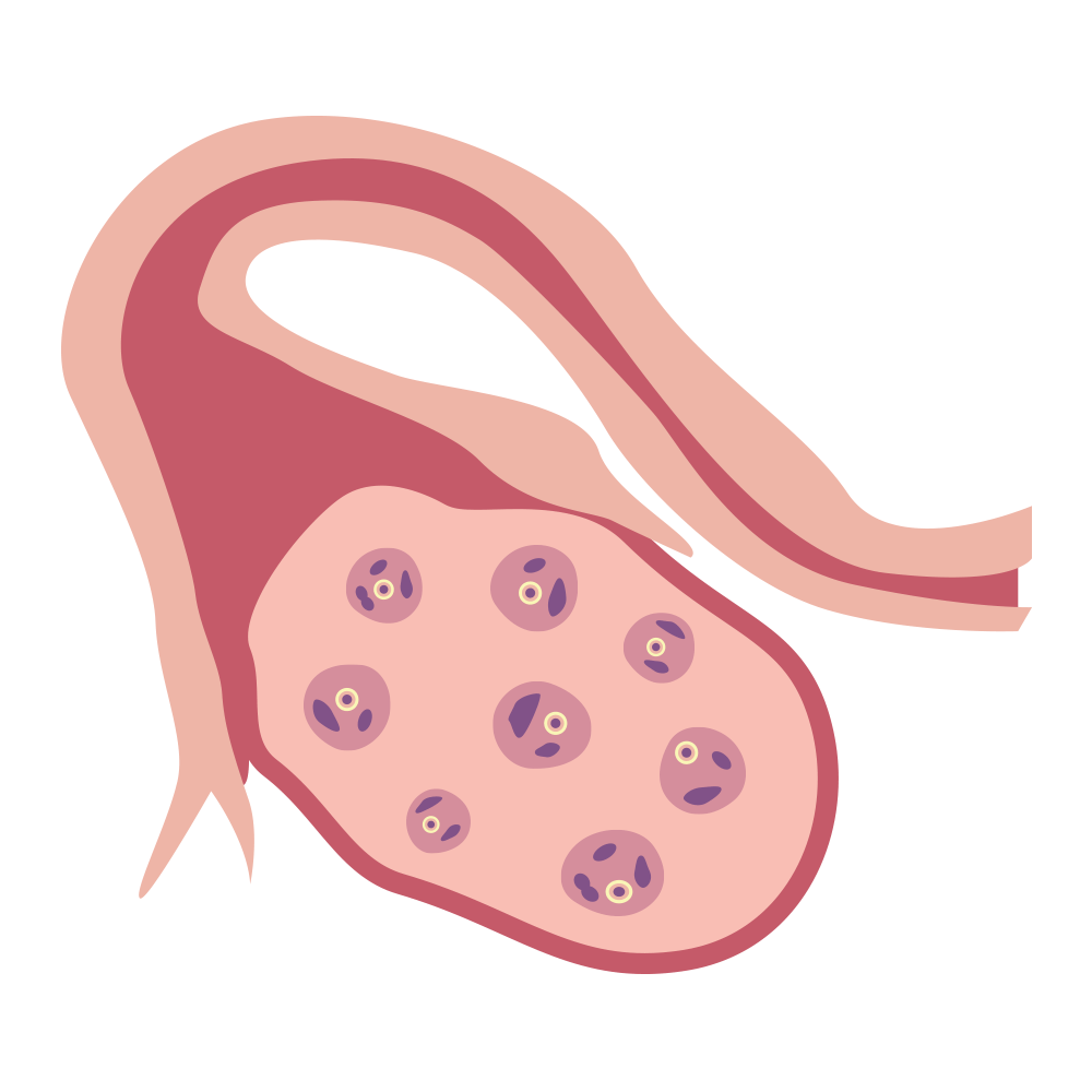 During a normal menstrual cycle, only one egg is released for ovulation, but many others are “activated” and then die away. Egg freezing attempts to save as many of these extra eggs as possible.