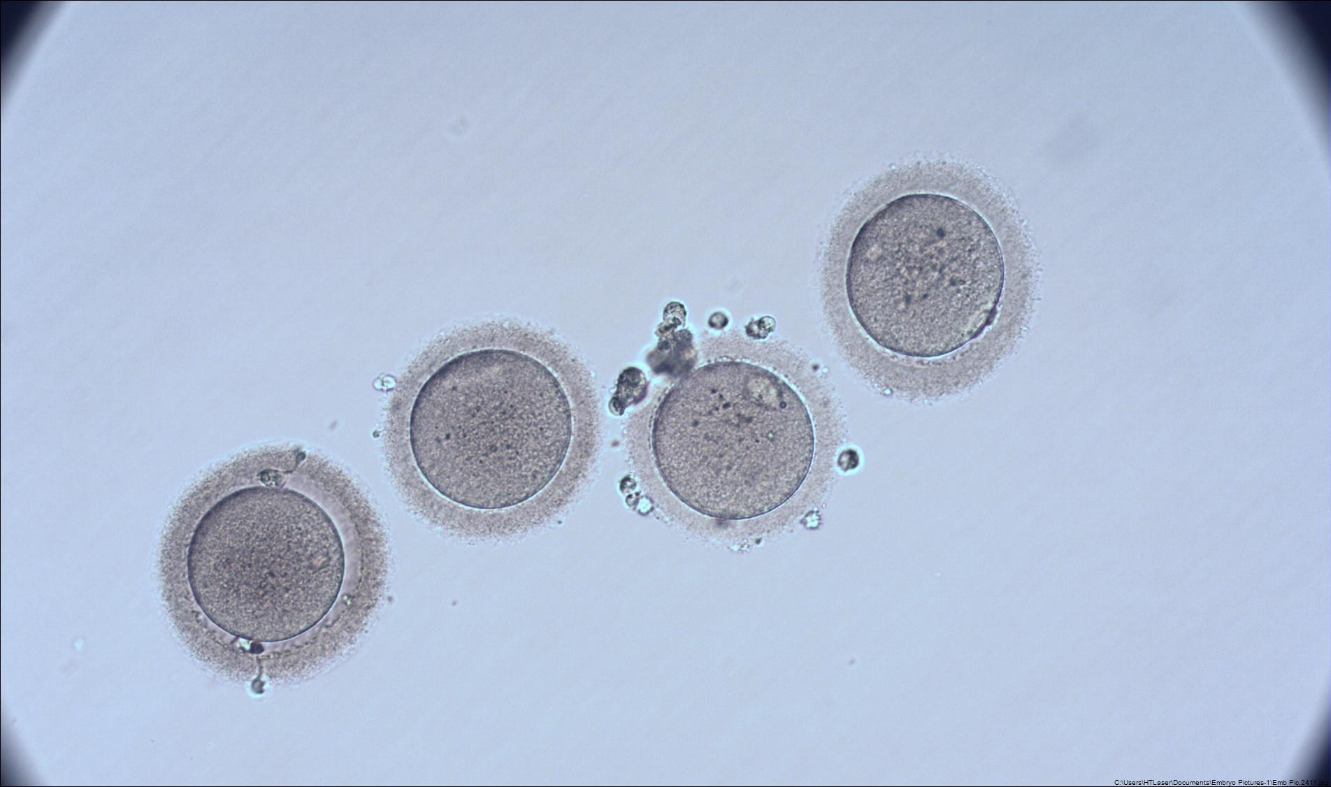 Eggs after an egg freezing cycle - ready to be frozen! (Source: Northern California Fertility Medical Center)