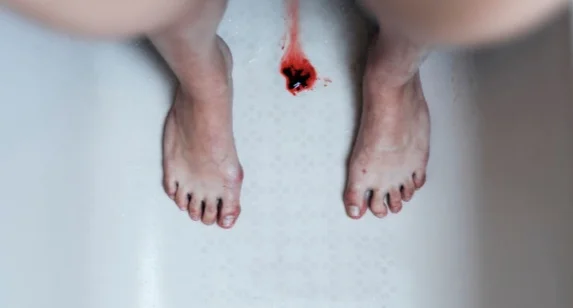 You may see clumps of blood or blood clots in your period, which is normal