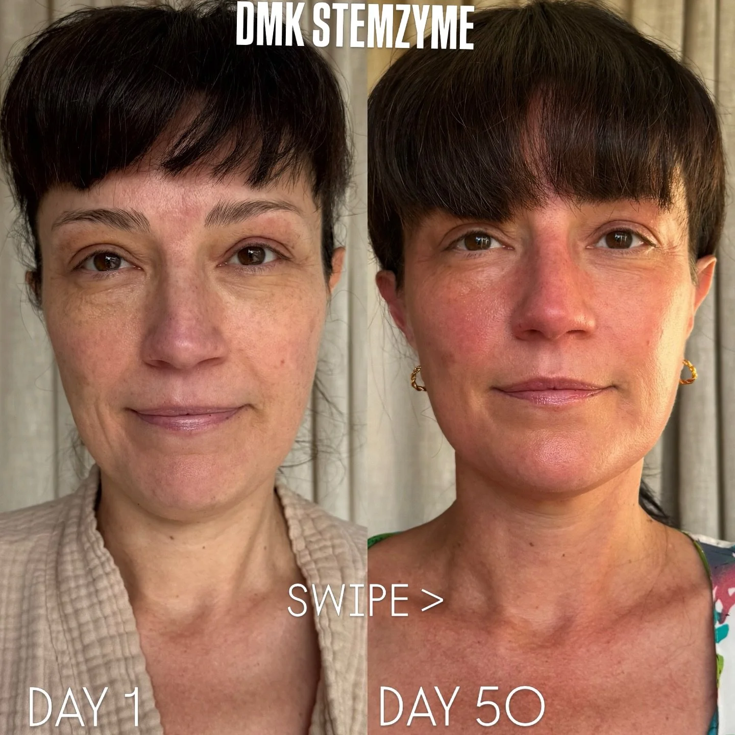 DMK&rsquo;s most advanced treatment, StemZyme&trade; is a 50-day program that represents the most advanced age management solution in the world today.

Utilizing biomimetic methods and a rich array of bioactive botanical ingredients, this highly-spec