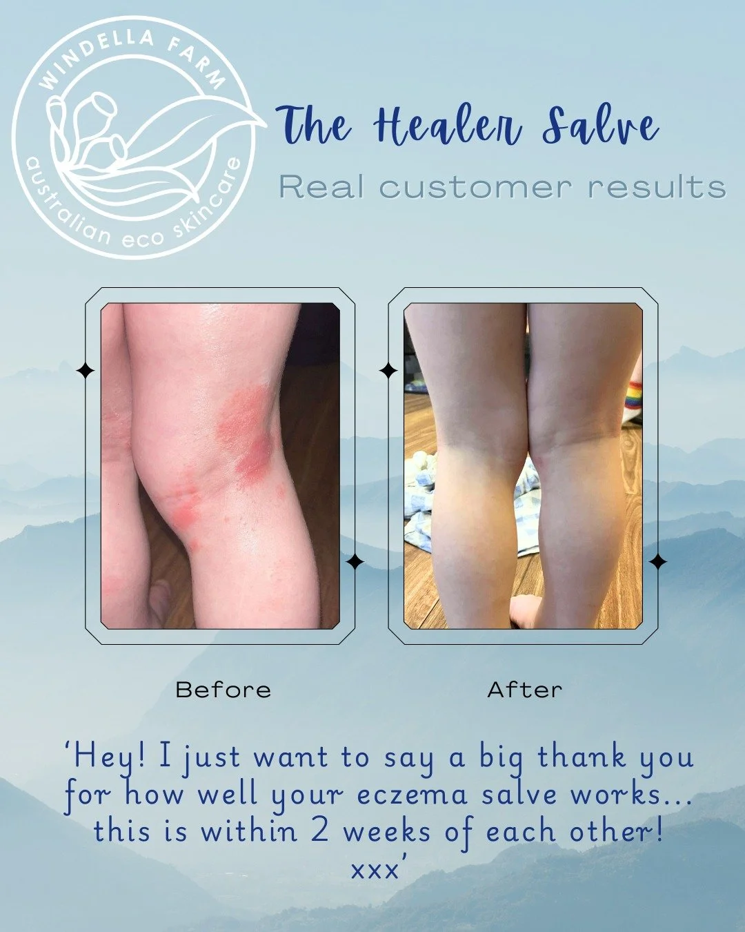 It's no secret that The Healer Salve is a really versatile &amp; effective product, but as an Australian skincare brand we have to be careful about making therapeutic claims. So we let our customers do the talking &amp; if you are a visual learner li