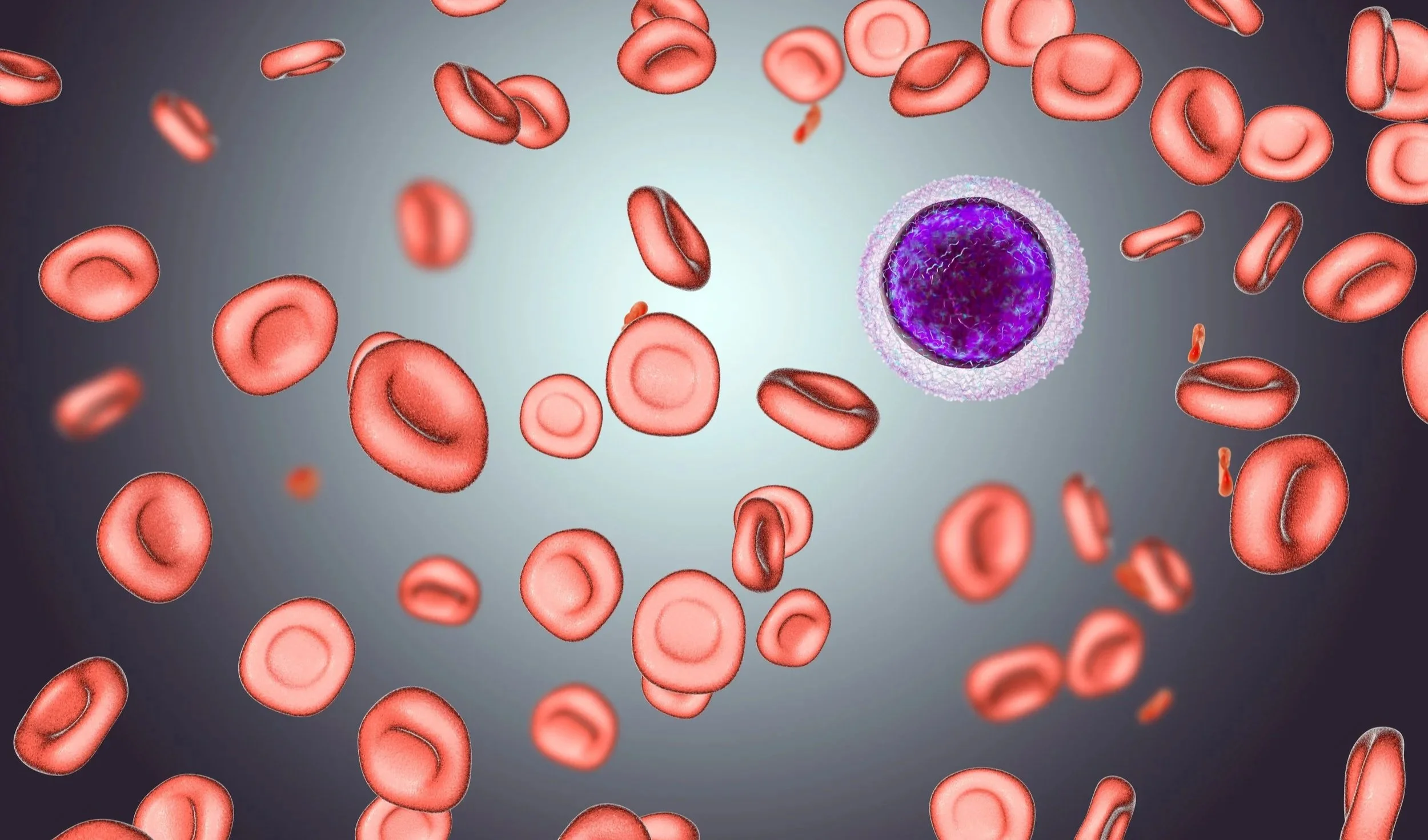 iron deficiency anemia pic.jpg