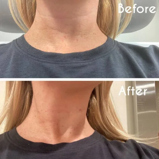 TECH NECK: Smoothing Out Horizontal Necklace Lines