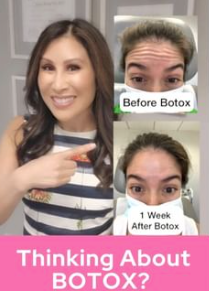 Thinking About Botox?