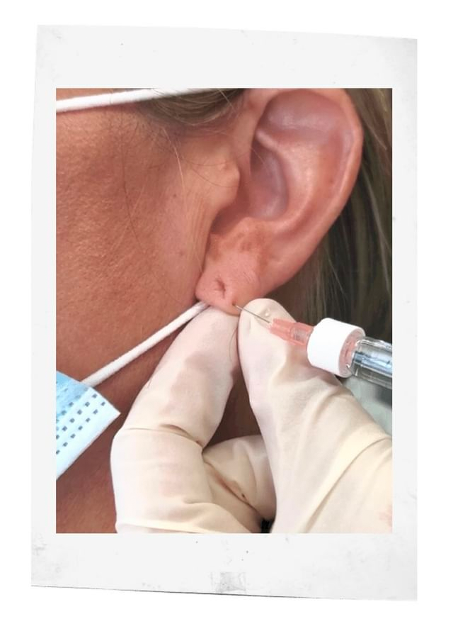 How To Get Perkier Earlobes