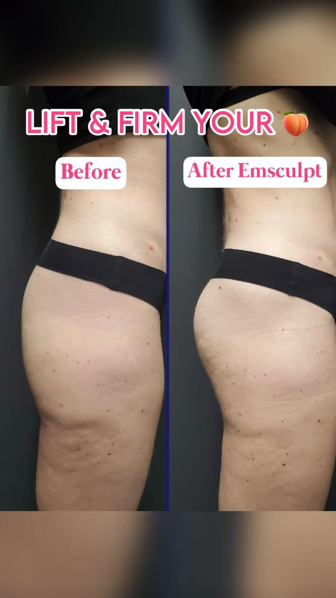 LIFT, FIRM, & STRENGTHEN