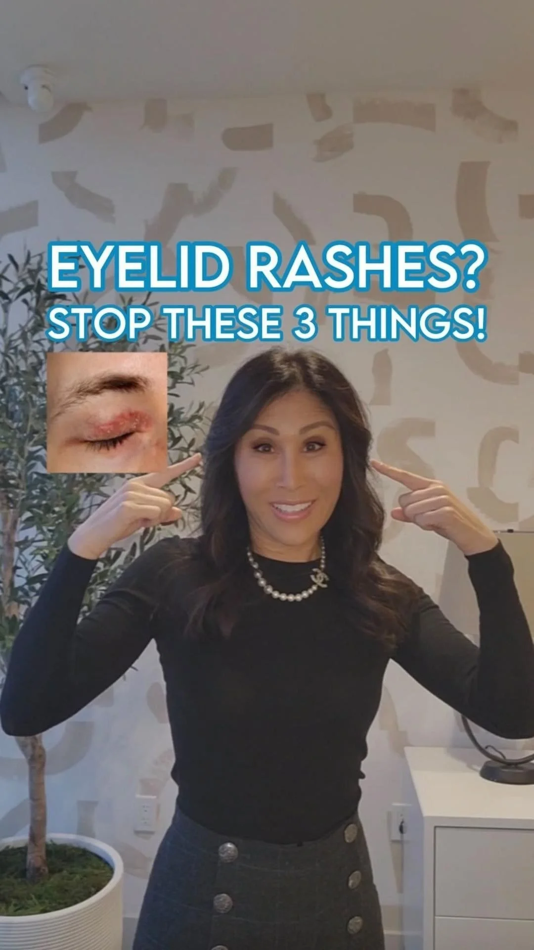 EYELID RASHES?