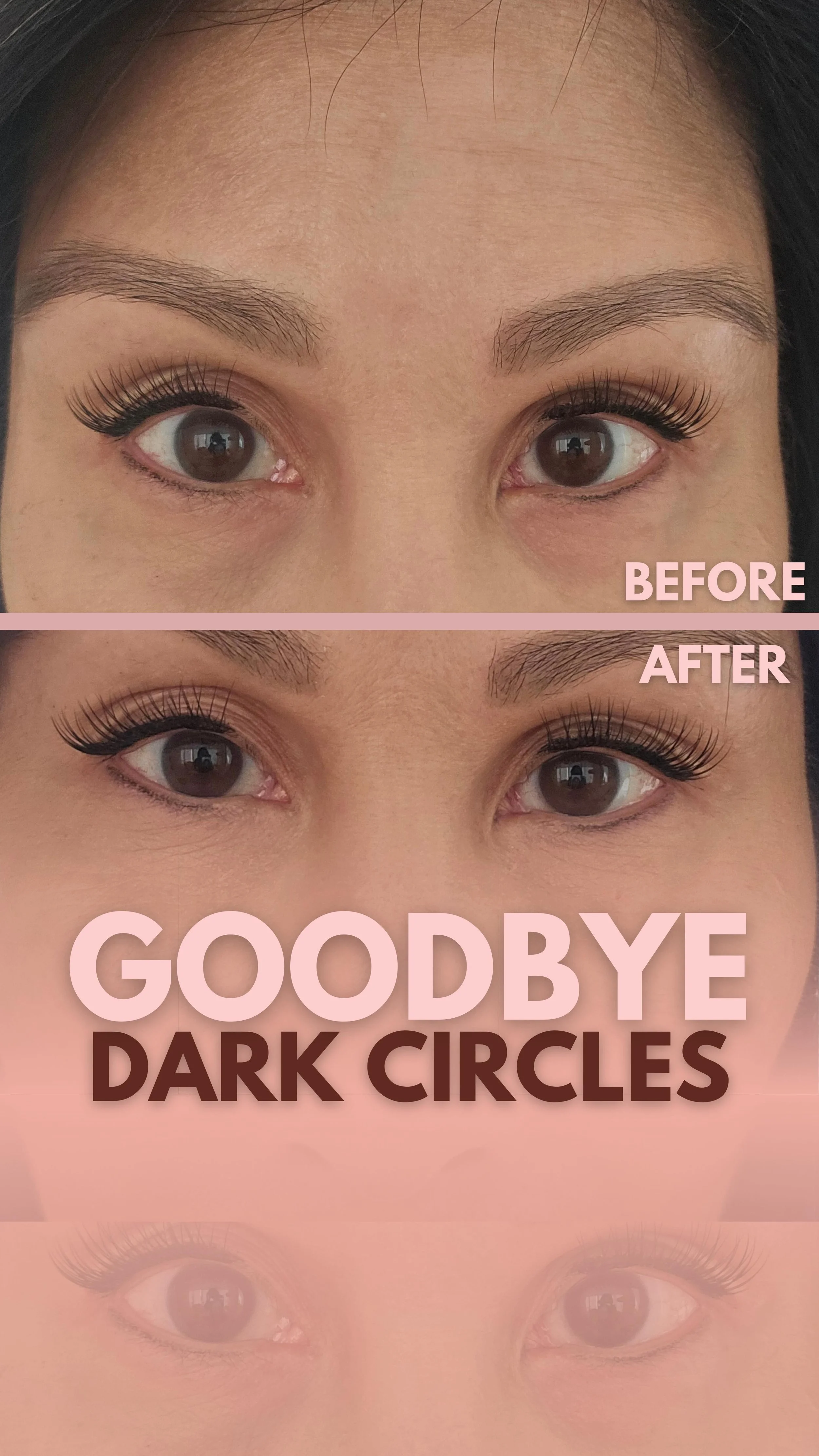 WHAT TO DO FOR DARK CIRCLES?