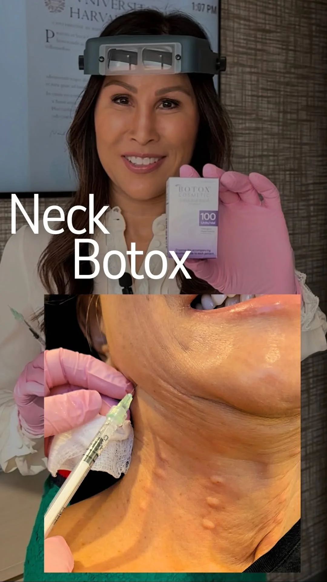 NECK BOTOX
