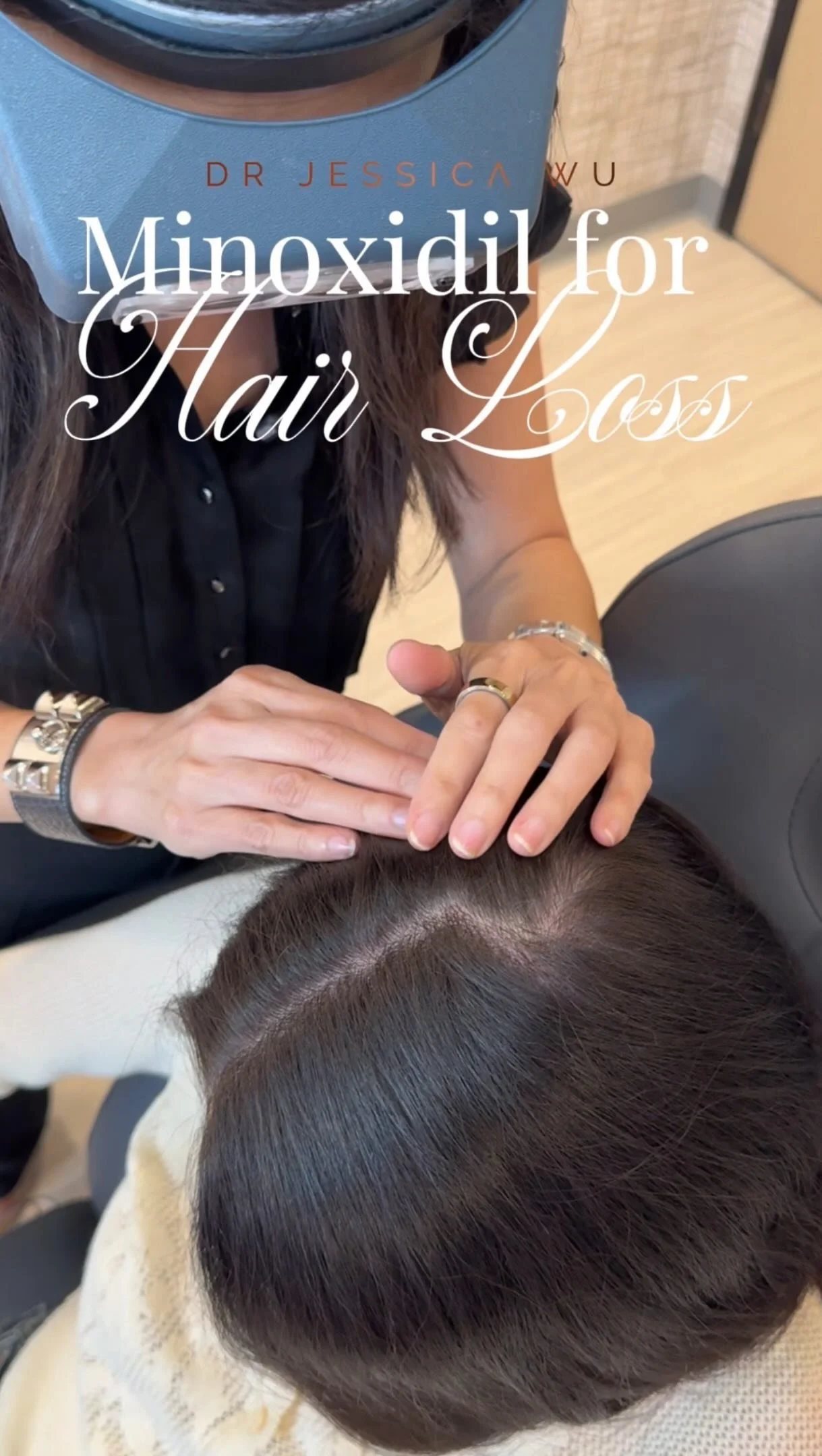 Minoxidil for Hair Loss