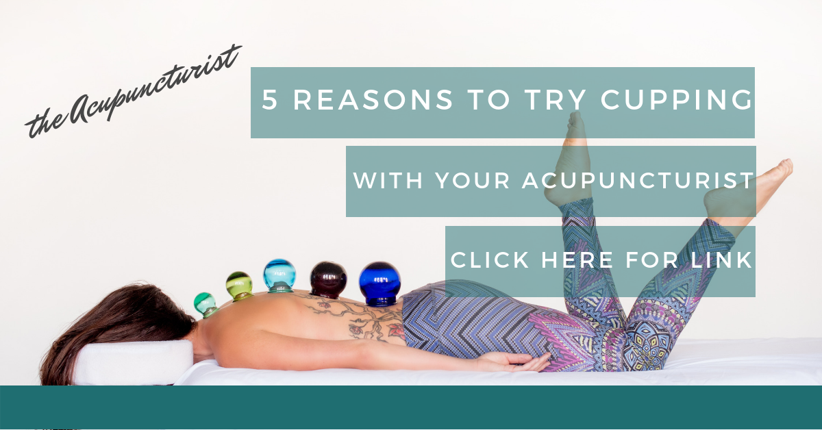 5 reasons to try cupping at your next acupuncture appointment