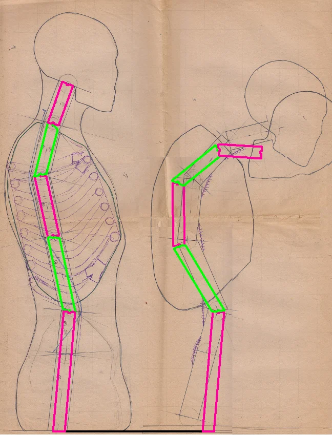 The geometry of the spinal segments in the upright and slumped positions