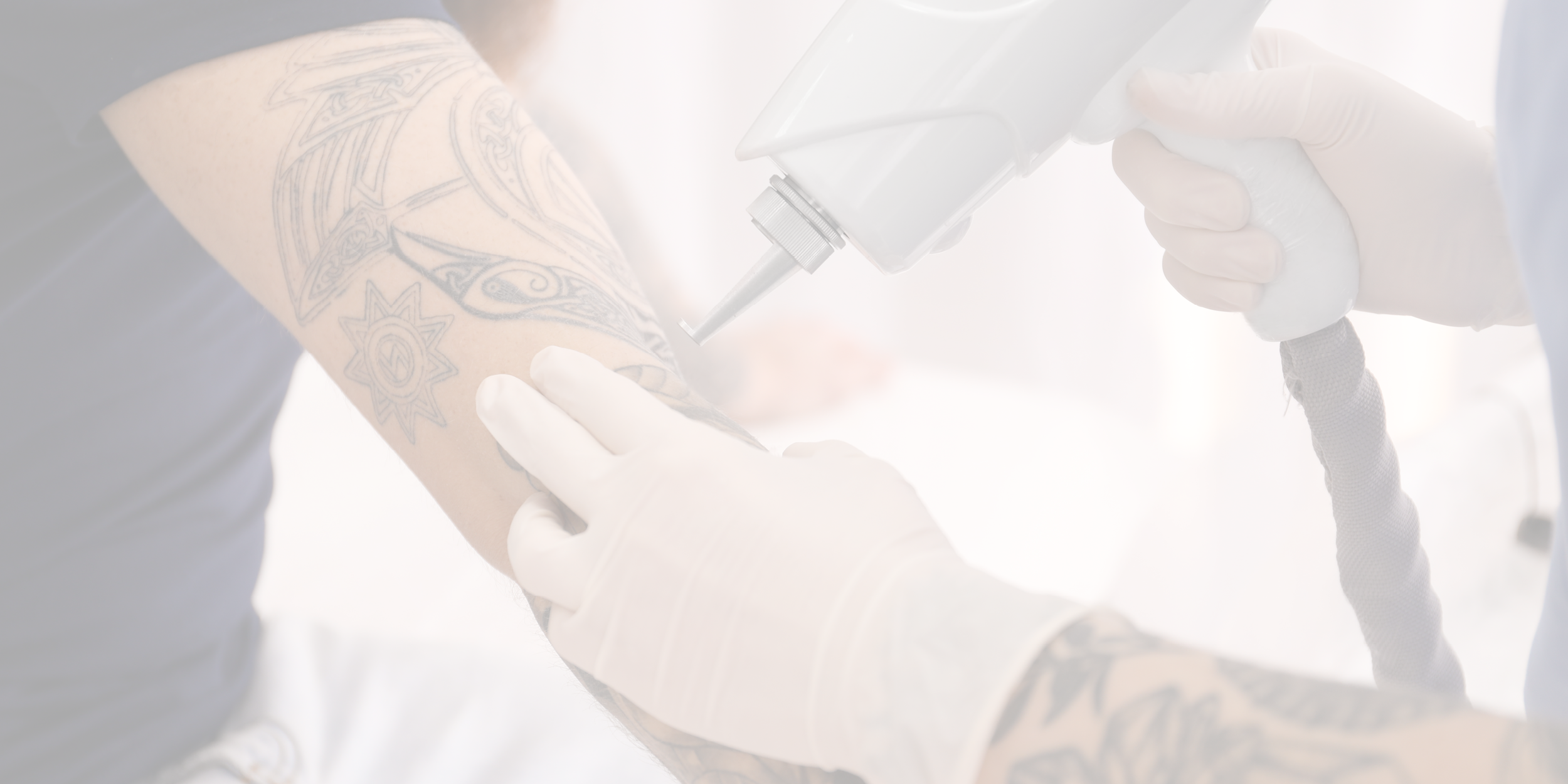 Laser Tattoo Removal and Laser Hair Removal Learning Center