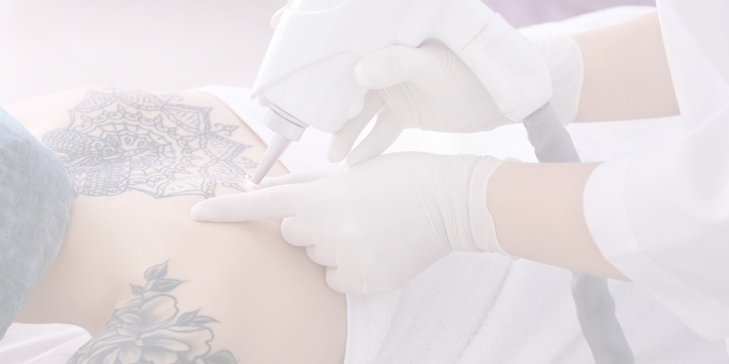 Laser Tattoo Removal Courses & Certification in Hamilton