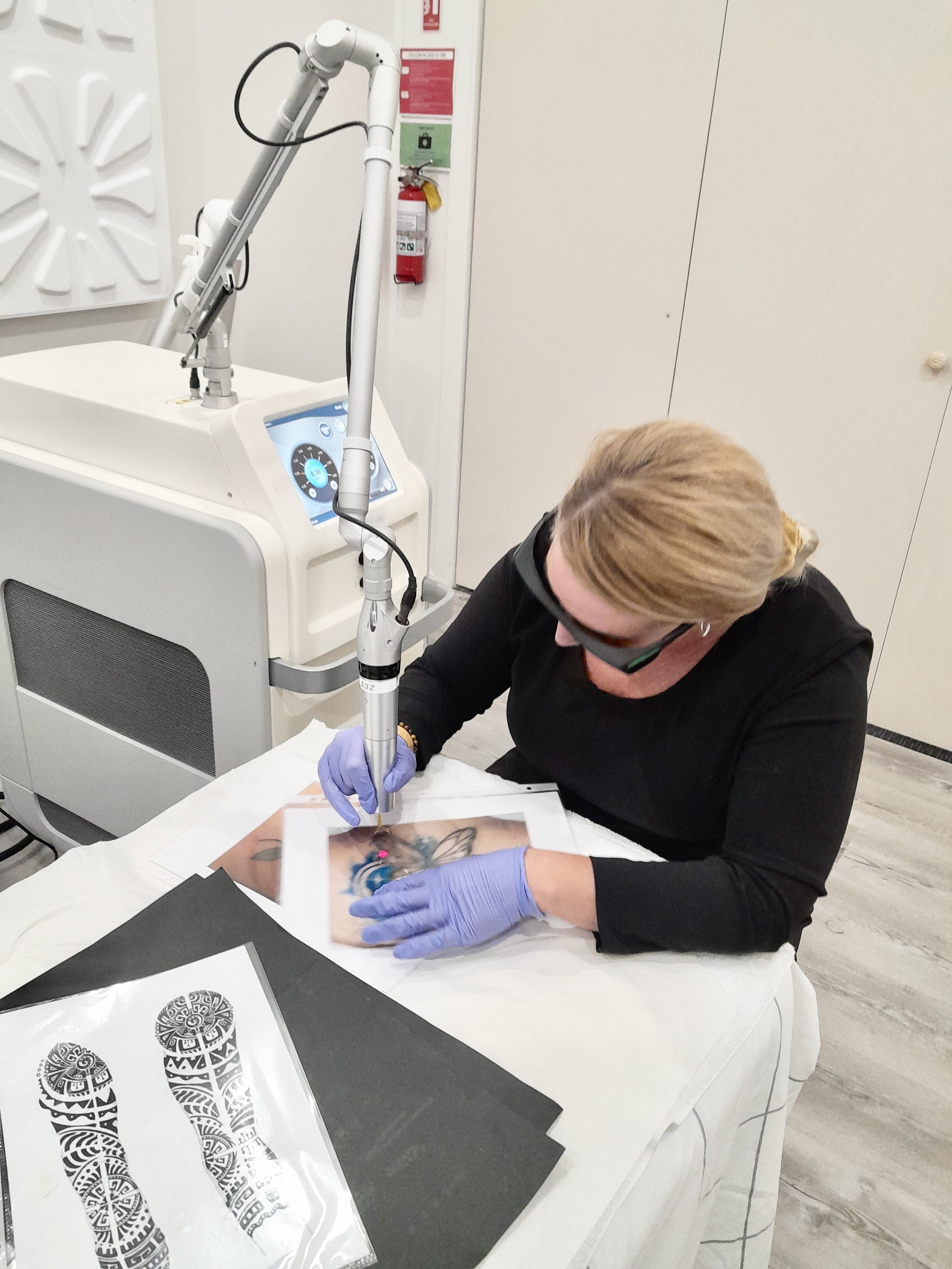 Laser Tattoo Removal in Thurlstone, England - Booksy
