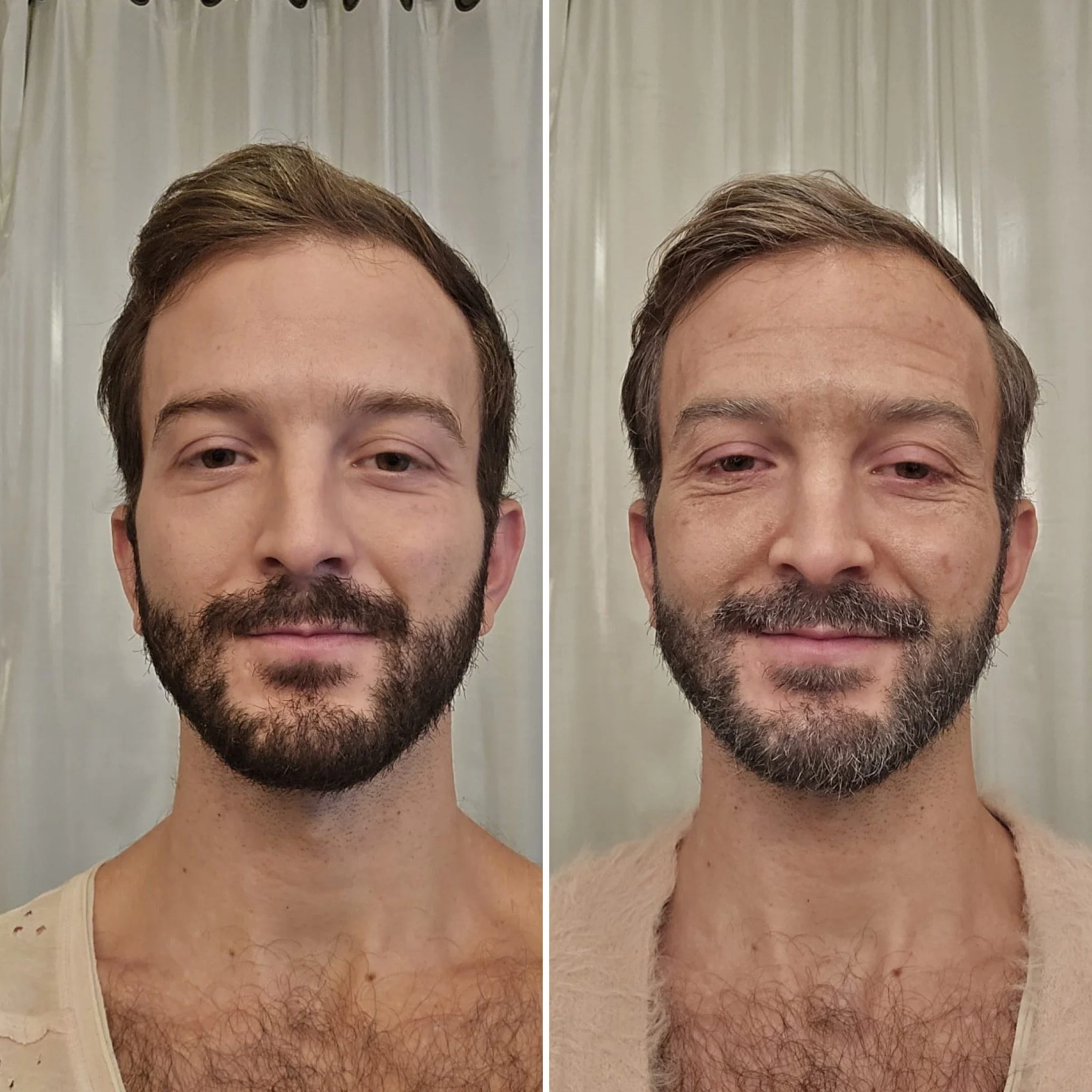 Aging 15-20 years (out-of-kit)